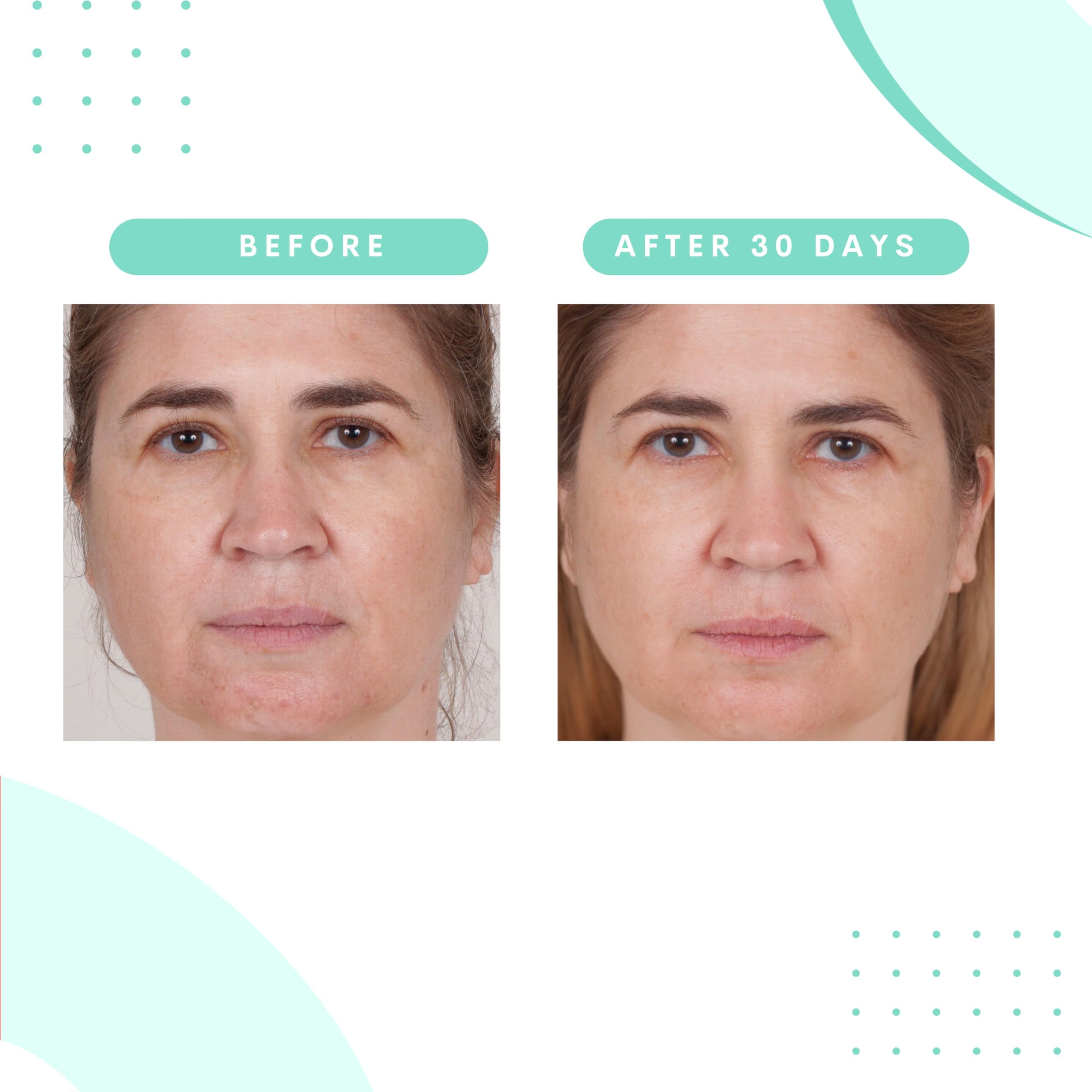 Serious Skincare - Glycolic Resurfacing Face Pads for Smoother Skin - Glycolic Acid - Exfoliates Dead Skin Cells - Pre-Soaked Co