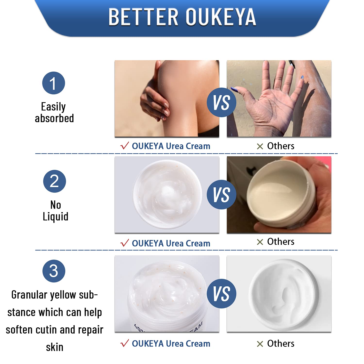 OUKEYA Urea Cream 40% - Maximum Strength Hand & Foot Lotion, 5.29 oz, White, for Dry Cracked Skin