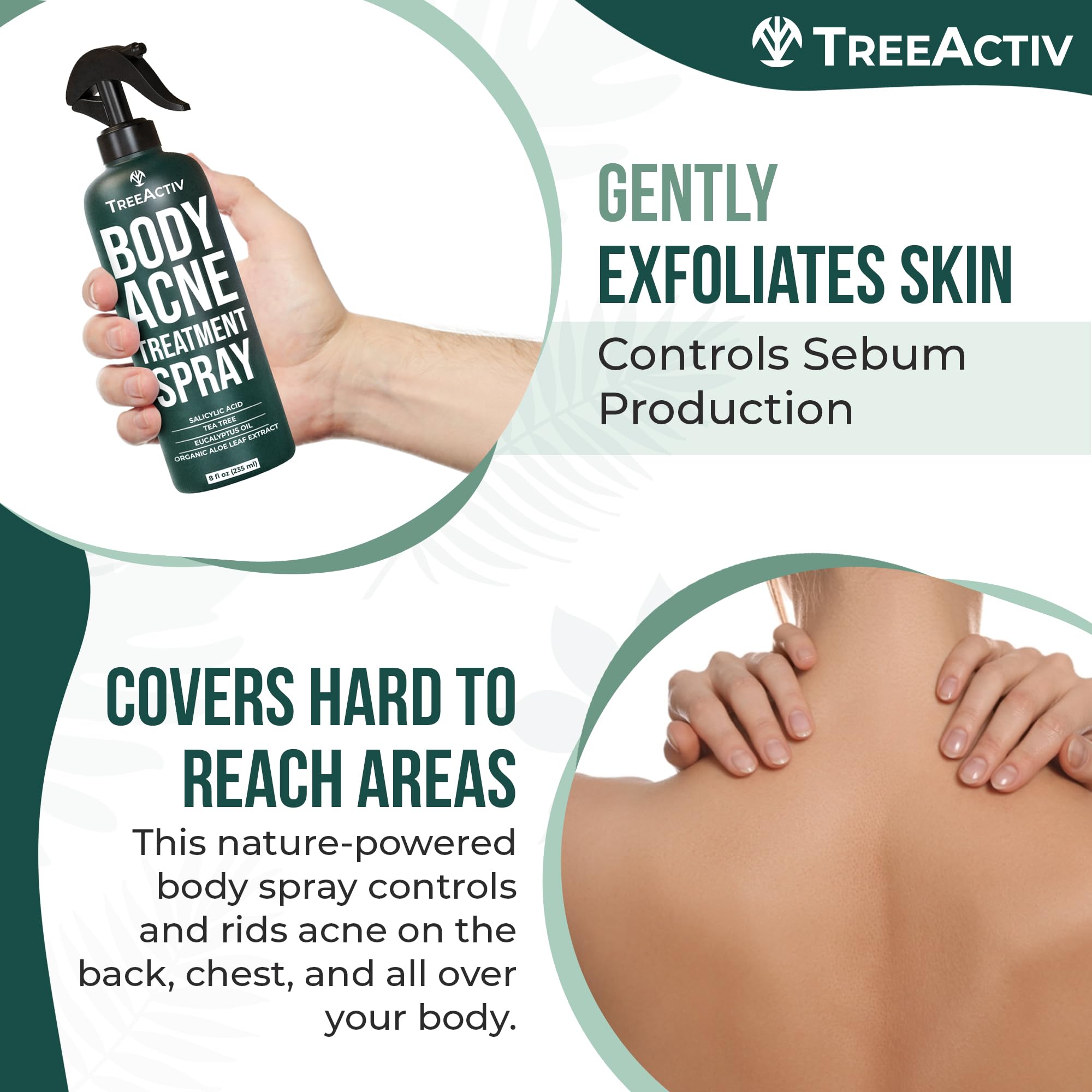 Treeactiv Body Acne Treatment Spray, 8 Fl Oz, 2% Salicylic Acid Spray For Body, Back Acne Treatment Spray With Tea Tree Oil And