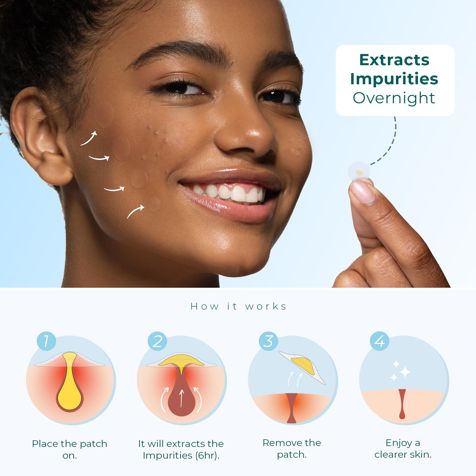 Hydrocolloid Pimple Patches (Made In Korea) Fsa/Hsa Eligible, Vegan, Hypoallergenic, Cruelty-Free | Acne Stickers, Overnight Tre