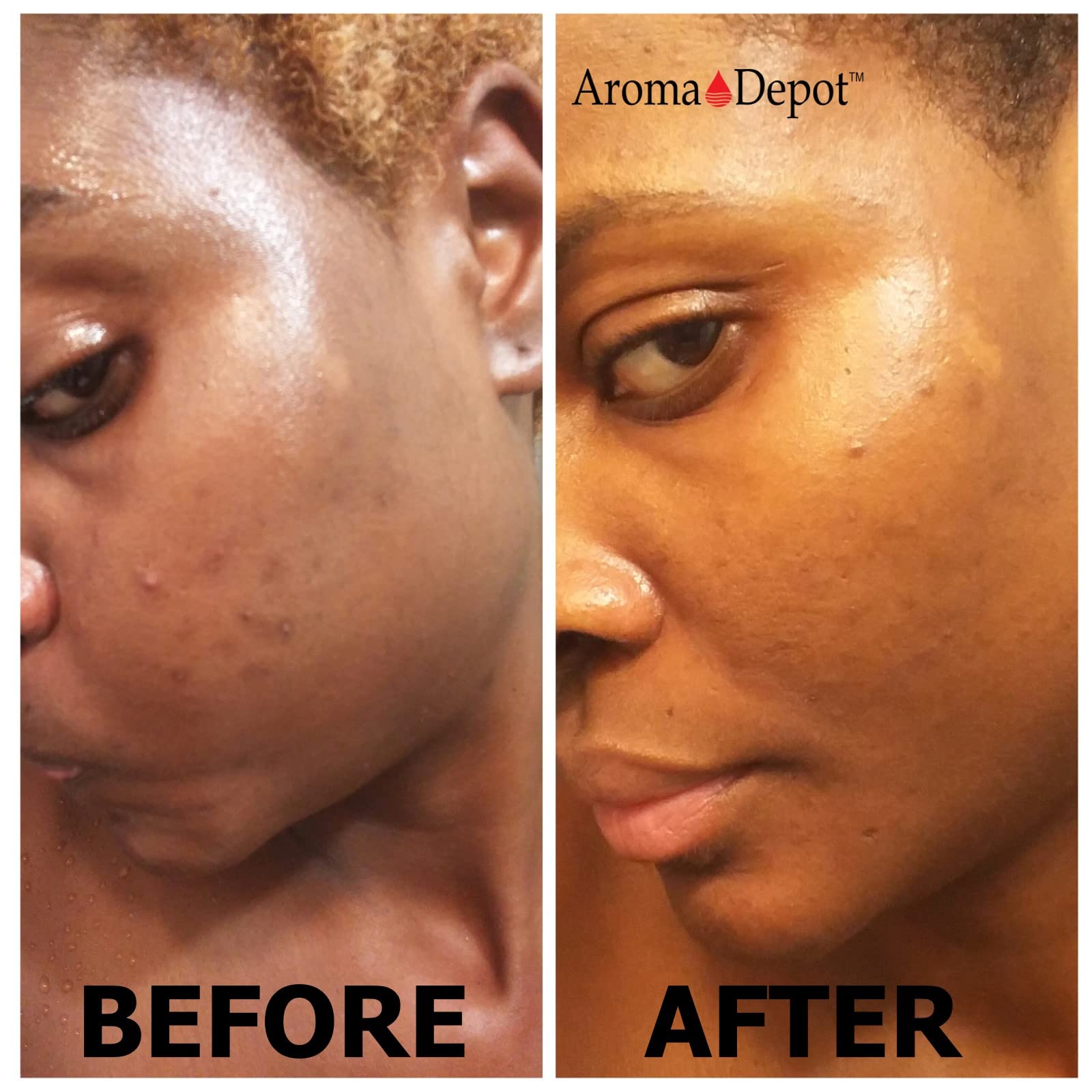 Aroma Depot Raw African Black Soap 8oz 100% Raw Natural soap for Acne, Eczema, Psoriasis, Scar Removal Face And Body Wash. Handm
