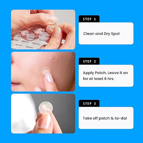 Avarelle Acne Cover Patch  Hydrocolloid Acne Pimple Patches  Zit Patches For Blemishes, Zits And Breakouts With Tea Tree, Calend