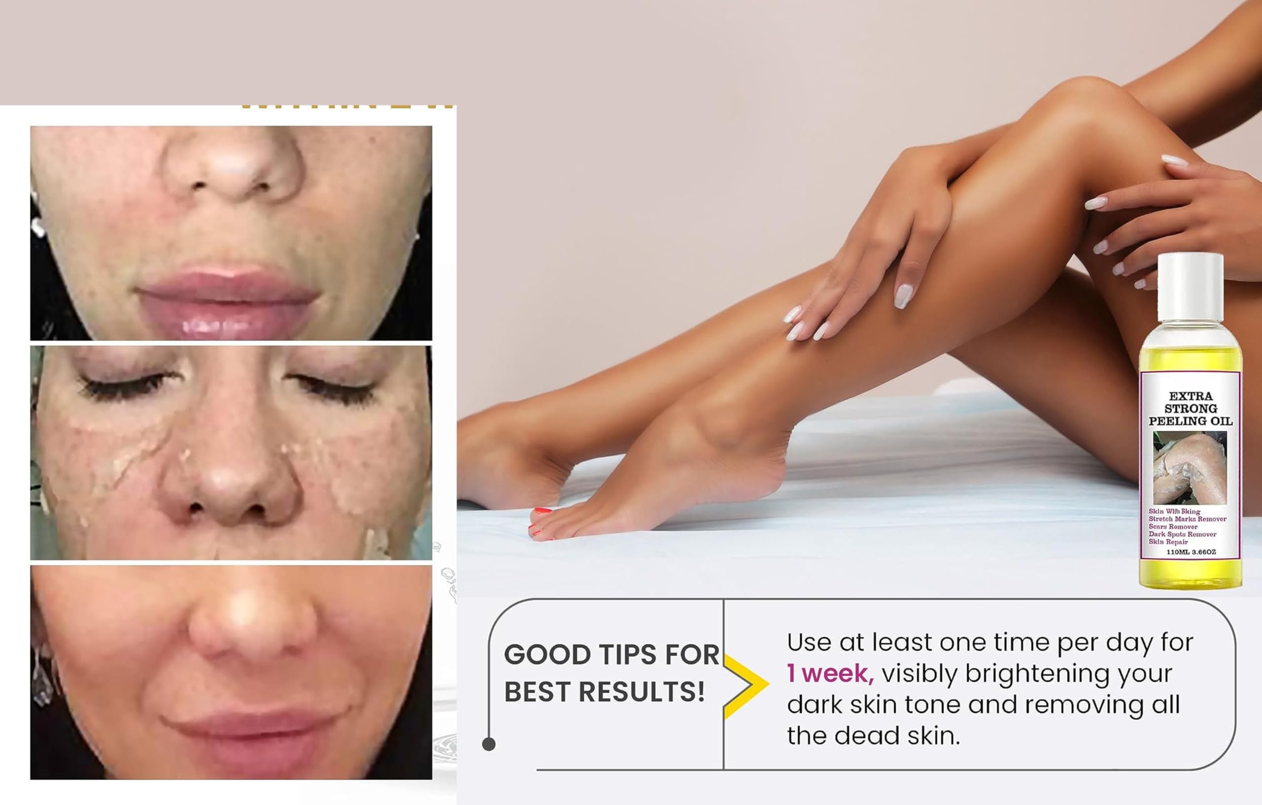 Yellow Peeling Oil, Chemical Peel Peeling Oil for Dark Skin, Strong Peeling Oil Extra Strength, Exfoliating Peeling Solution for