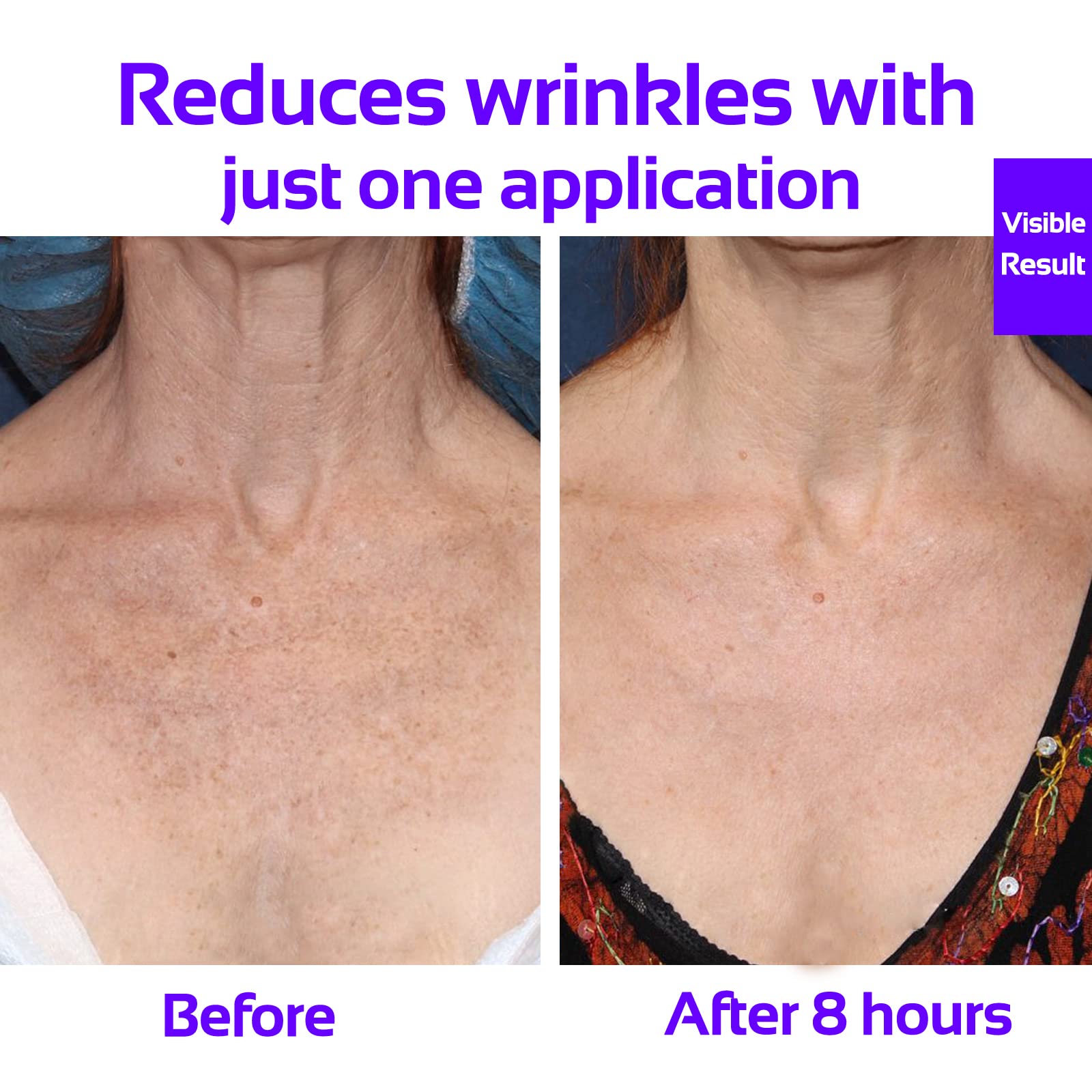 Skywee Professional Products Chest Wrinkle Pads Upgraded - Decollete Anti Cleavage Wrinkles Silicone Pad Set Of 3 Reusable Patch