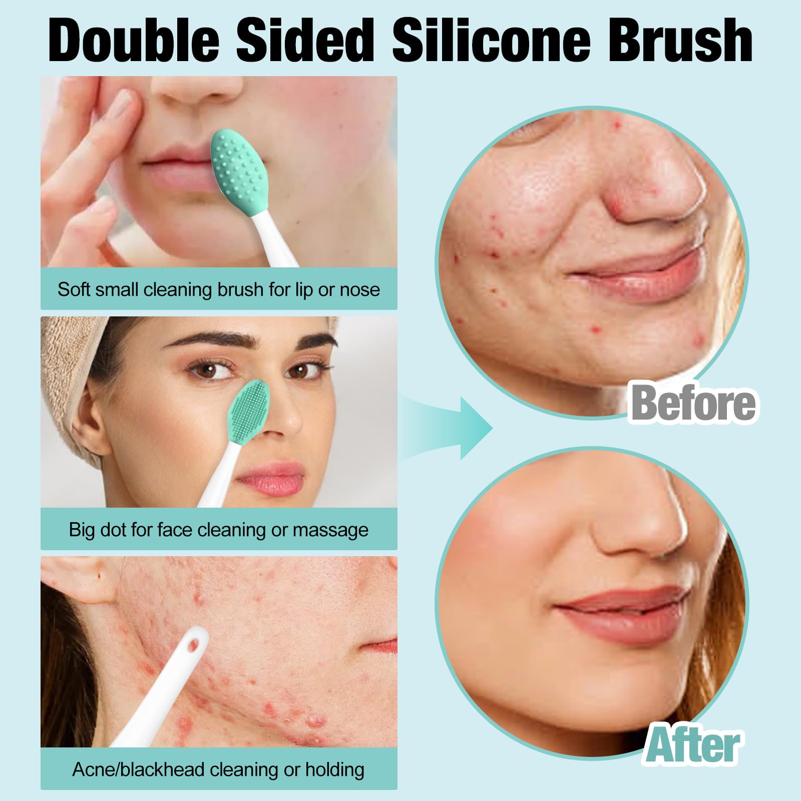 MUIIGOOD 3Pcs Blackhead Remover Pimple Popper Tool Kit Pimple Extractor Acne Treatment Surgical Grade Blackhead Comedone Removal