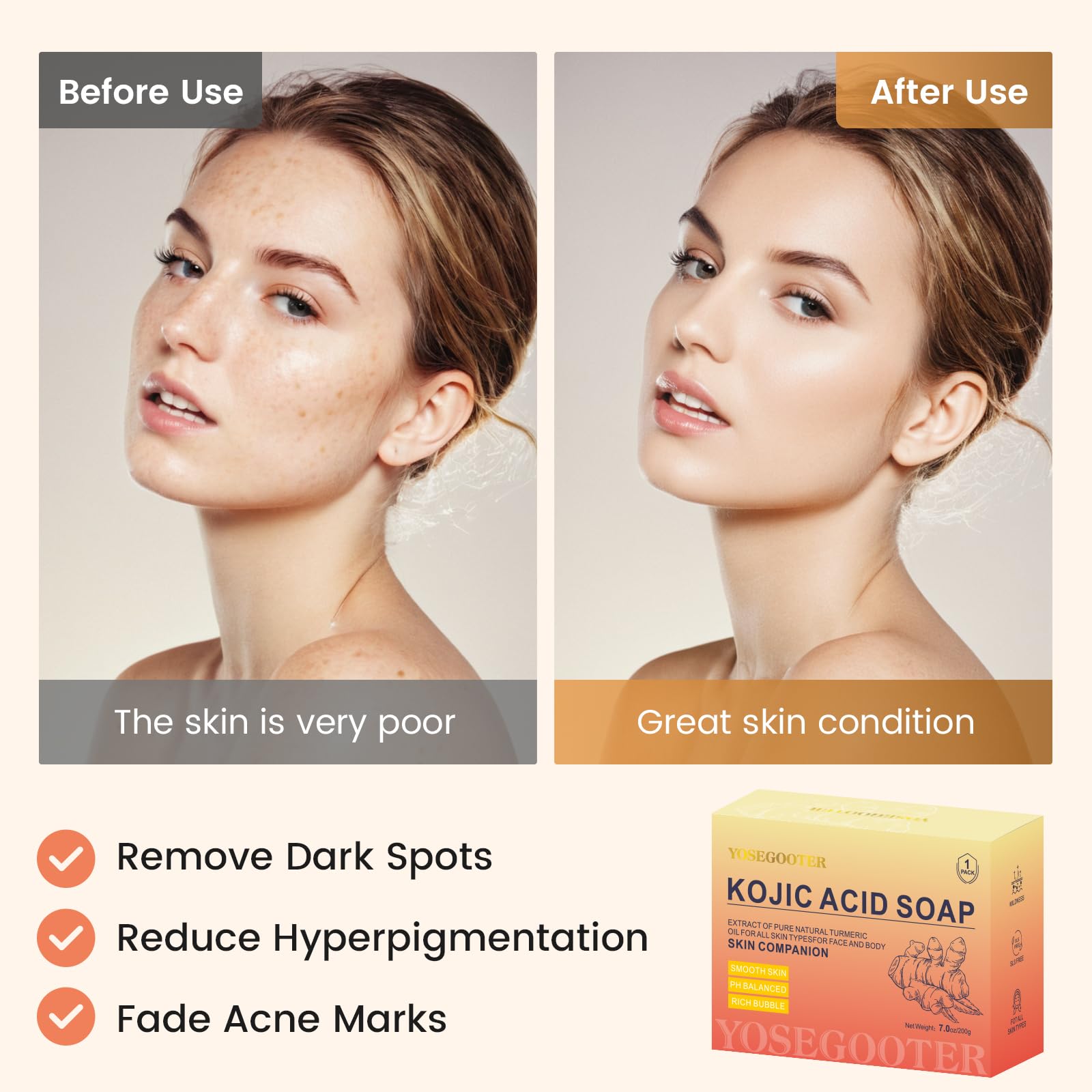 YOSEGOOTER Turmeric Kojic Acid Soap Bars - Face&Body Dark Spots Remover, Natural and Organic Ingredients Skin Care Body Wash Pad