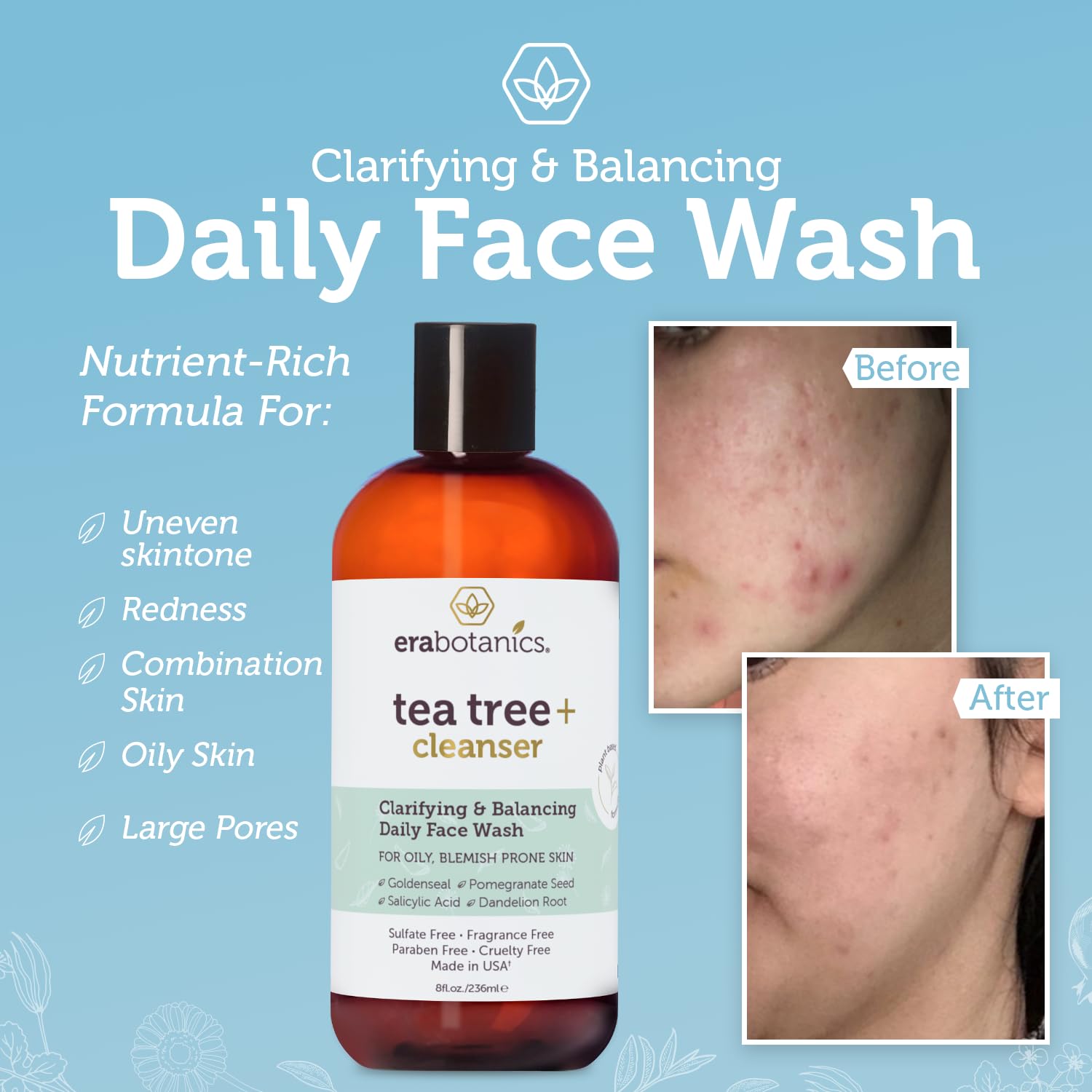 Era Organics Purifying Tea Tree Oil Face Wash - Balancing Cleanser for Oily, Blemish-Prone Skin with Salicylic Acid - Sulfate-Fr
