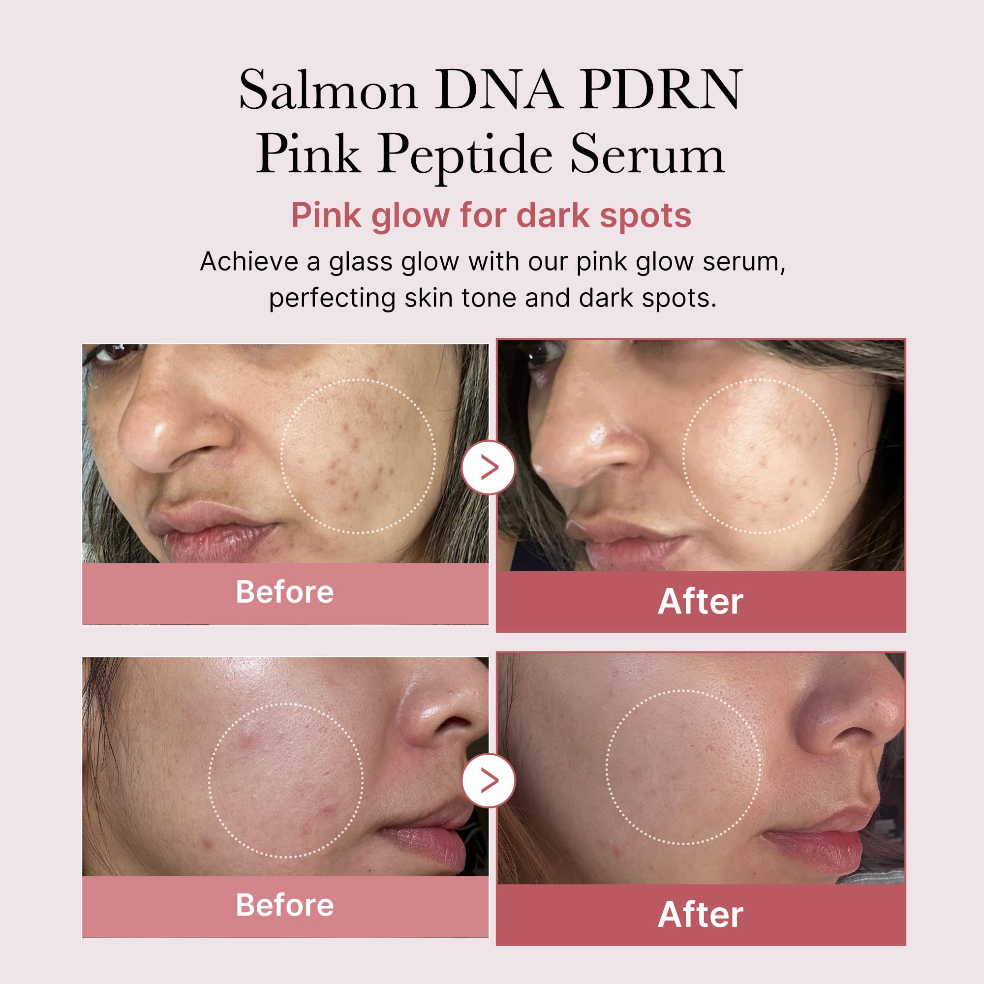 medicube Salmon DNA PDRN Pink Peptide Serum - Hydrating, Firming, Niacinamide - 1.01 fl. oz. Korean Skincare for Uneven Skin Tone