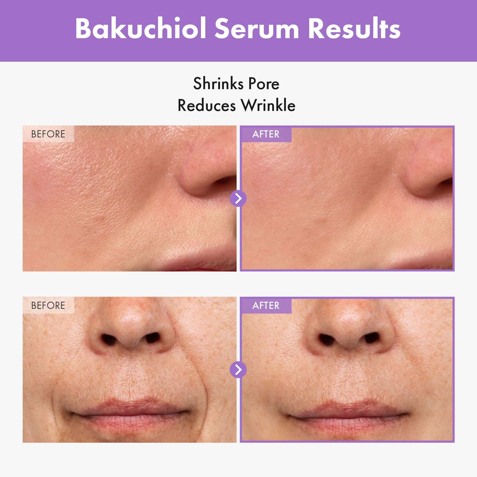 Tosowoong Bakuchiol Serum, 5,000Ppm Bakuchiol, Anti-Aging, Pore Minimizer For Face, Hydrating Glow Serum, Facial Moisturizer, Ac