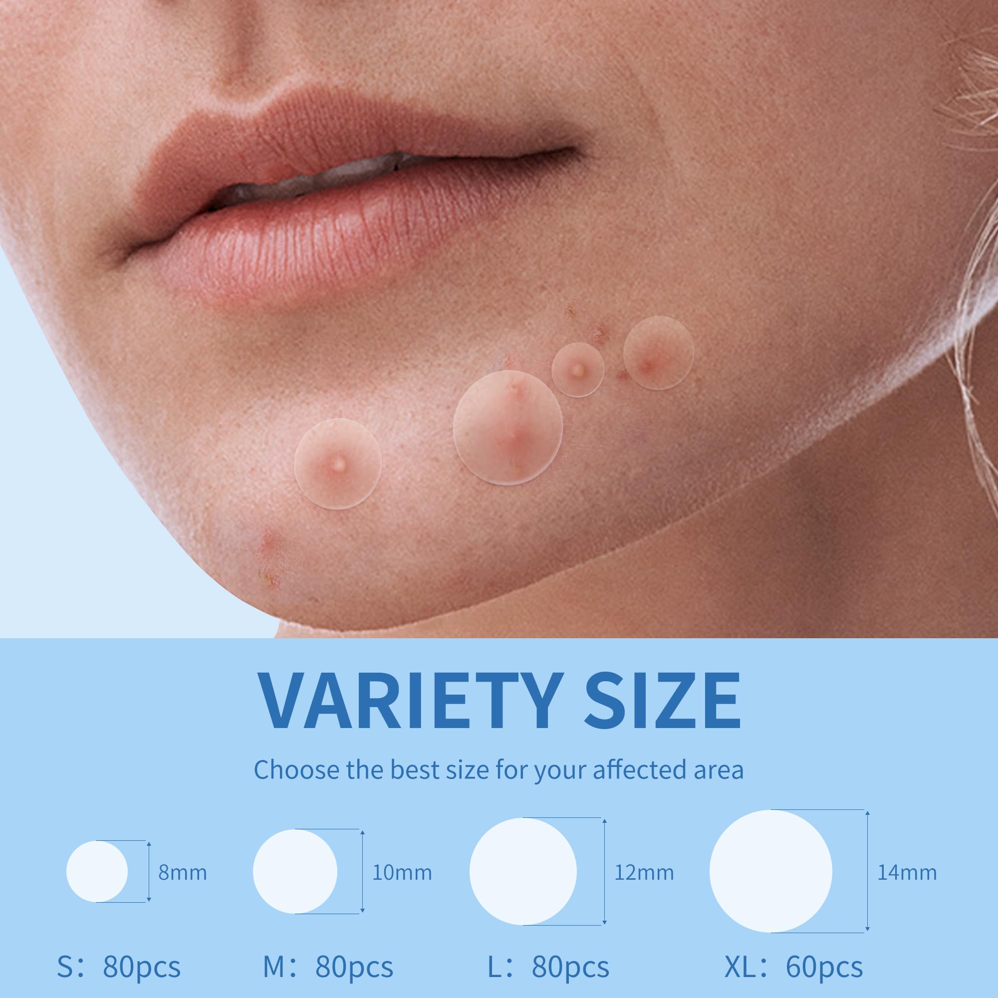 Daolyo Pimple Patches For Face, 4 Size 300 Counts Acne Patches, Hydrocolloid Patches For Covering Zits And Blemishes, Spot Stick