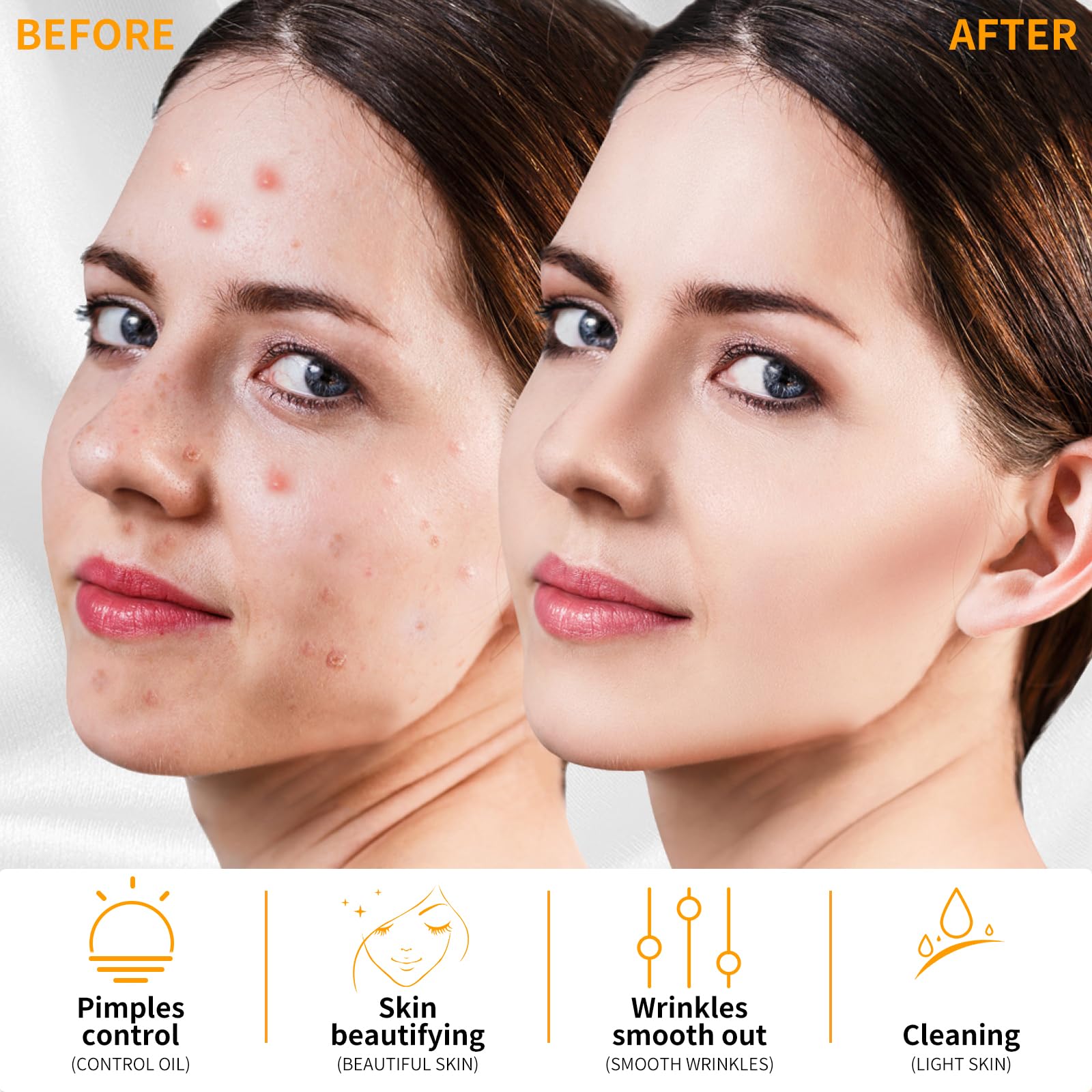 Mysweety High F Rrequncy Portable Handheld Facial Skin Care Wand Machine