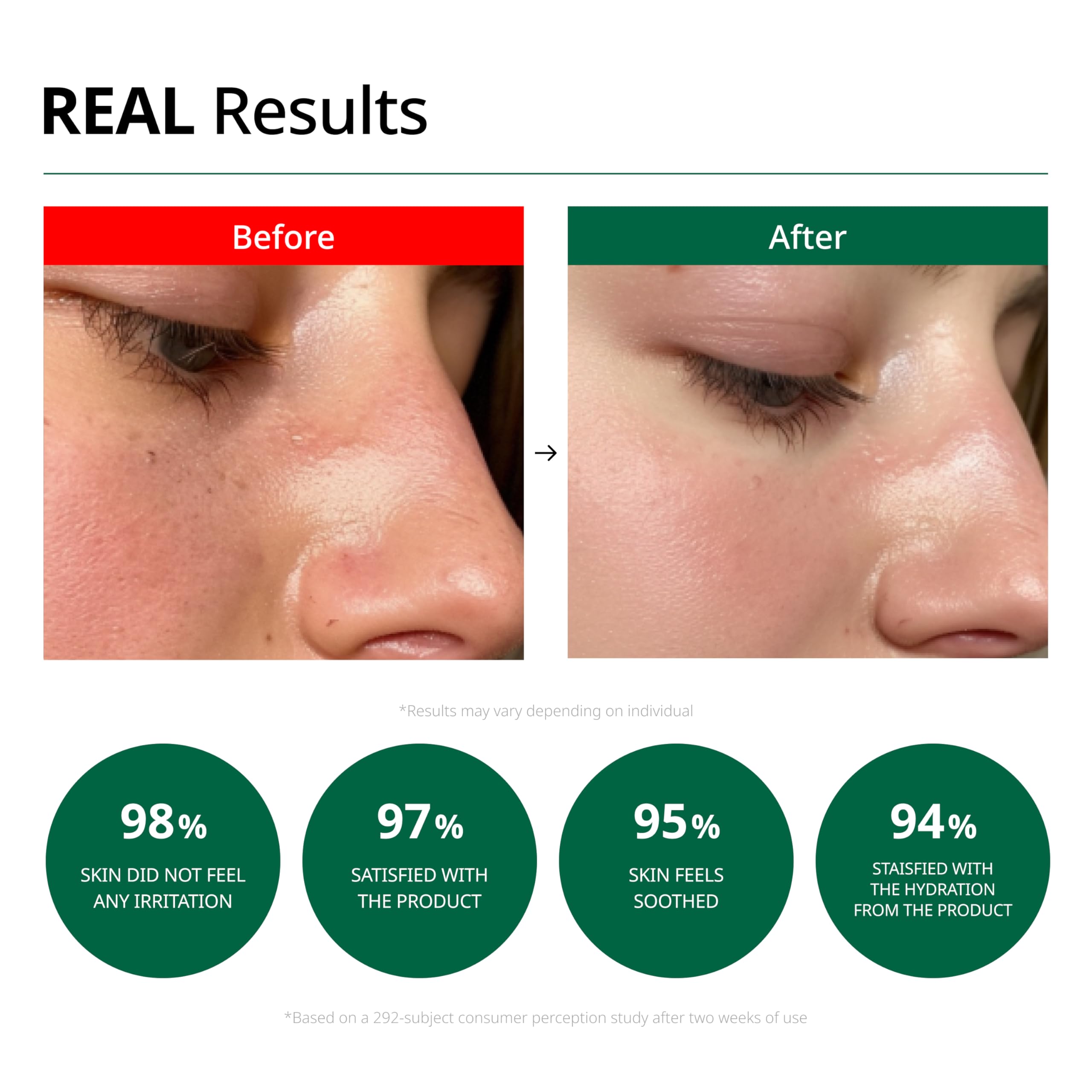Dr.G Red Blemish Clear Soothing Cream, 70Ml - Moisturizing Recovery Cream For Sensitive Acne-Prone Skin; Cica Soothing Moisturiz