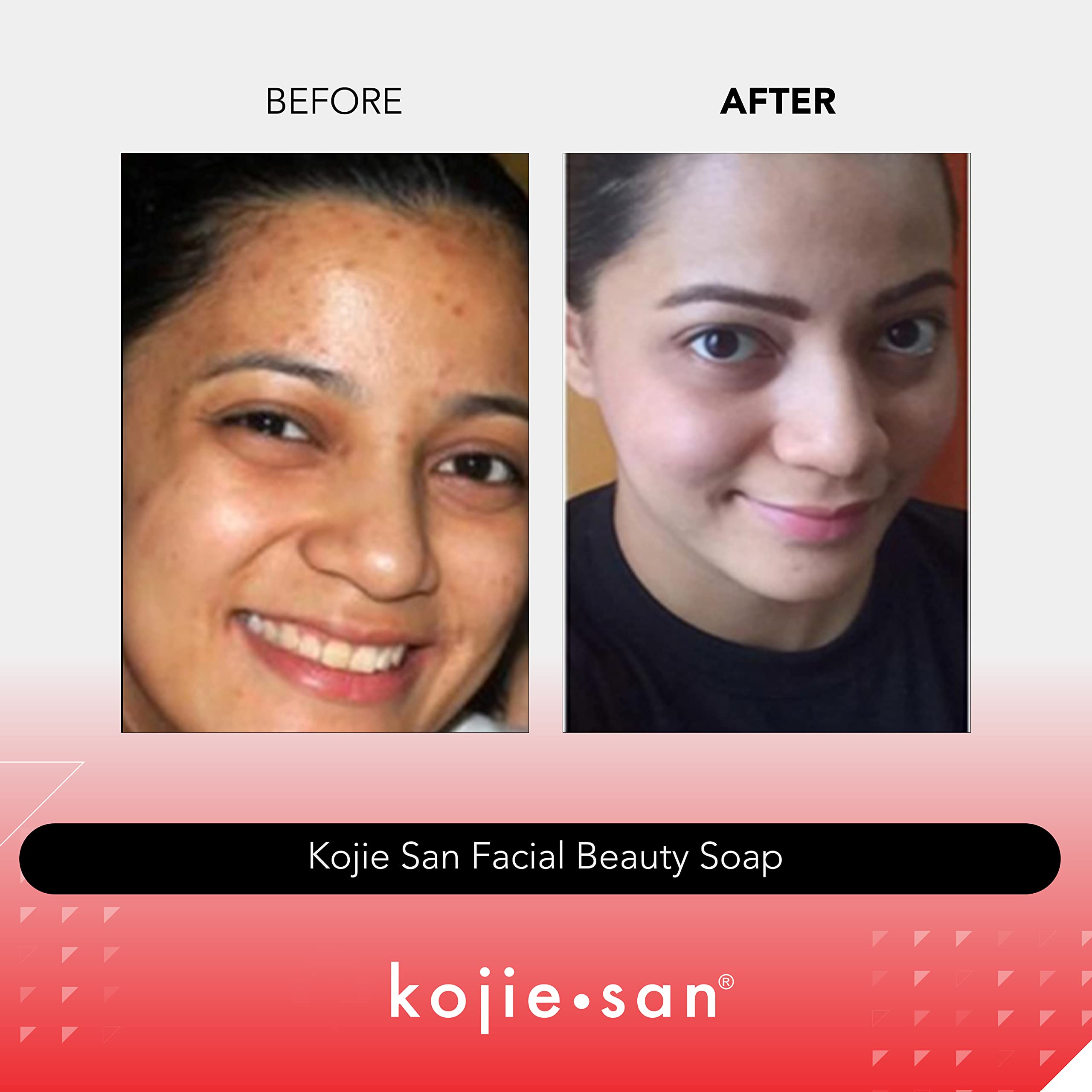 Kojie San Skin Brightening Soap - Original Kojic Acid Soap for Dark Spots, Hyperpigmentation, & Scars - Beauty Bar with Coconut