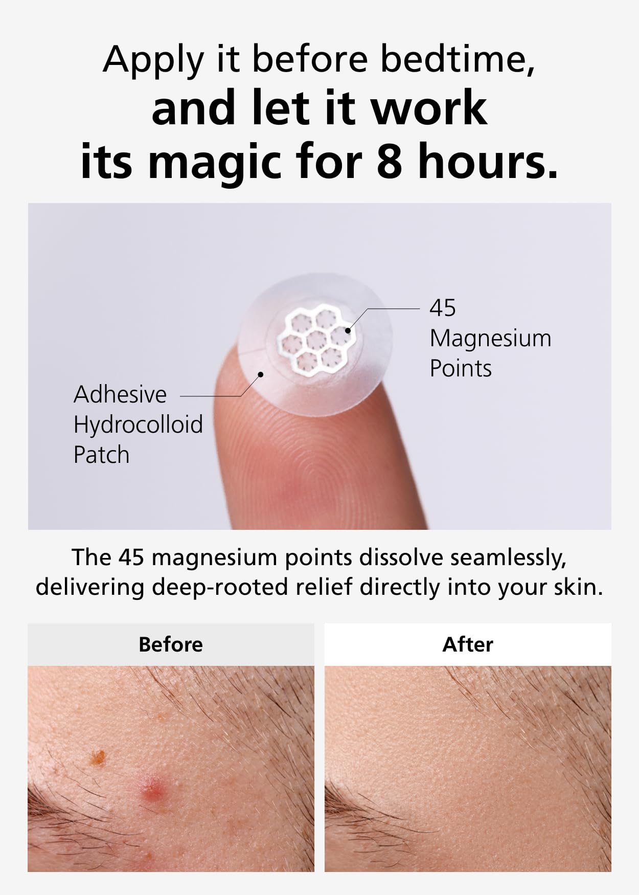 EasyDerm Quick Calming Magnesium Patches (30 patches) with Cica Ampoule