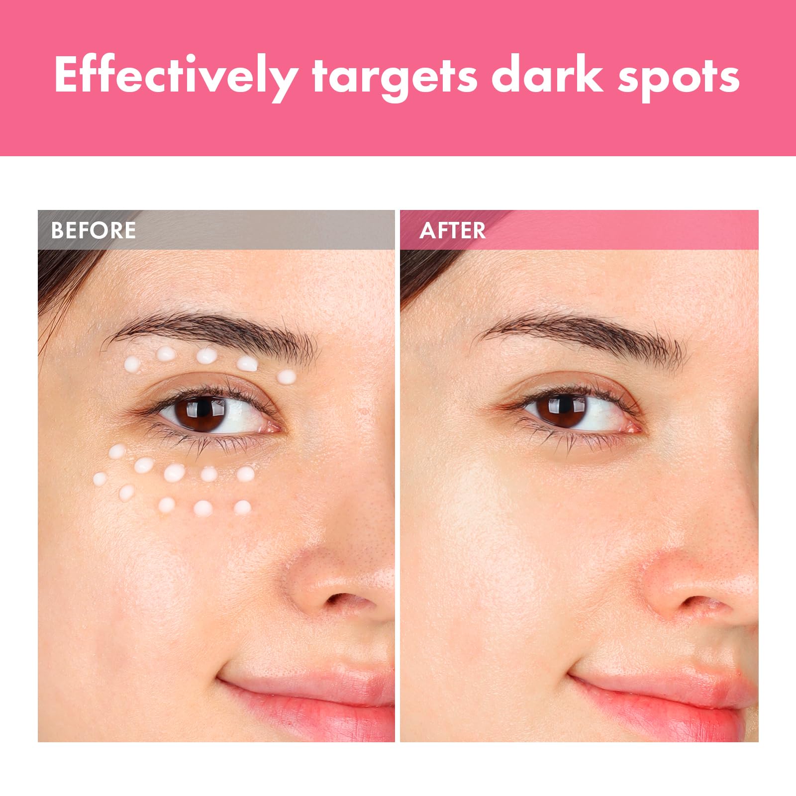 TOSOWOONG Arbutin 7% Intensive Spot Cream with 70,000ppm Arbutin, 3% Tranexamic Acid, 1% Niacinamide, Glutathione, Dark Spots, f