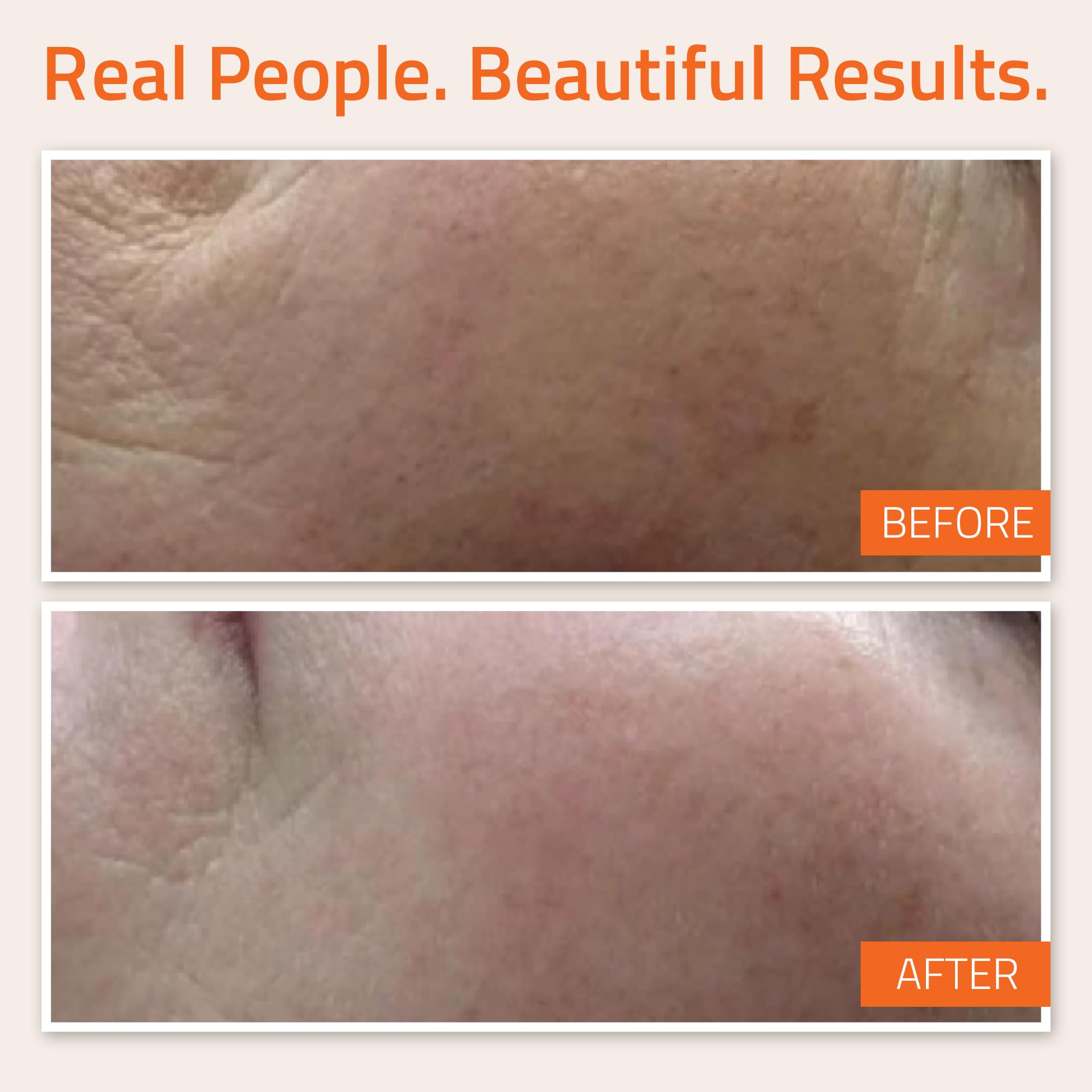 YEOUTH Vitamin c Serum for Face, Anti Aging Serum, Vitamin c Face Serum with Hyaluronic Acid, Vitamin c Serum Dark Spots & Wrink