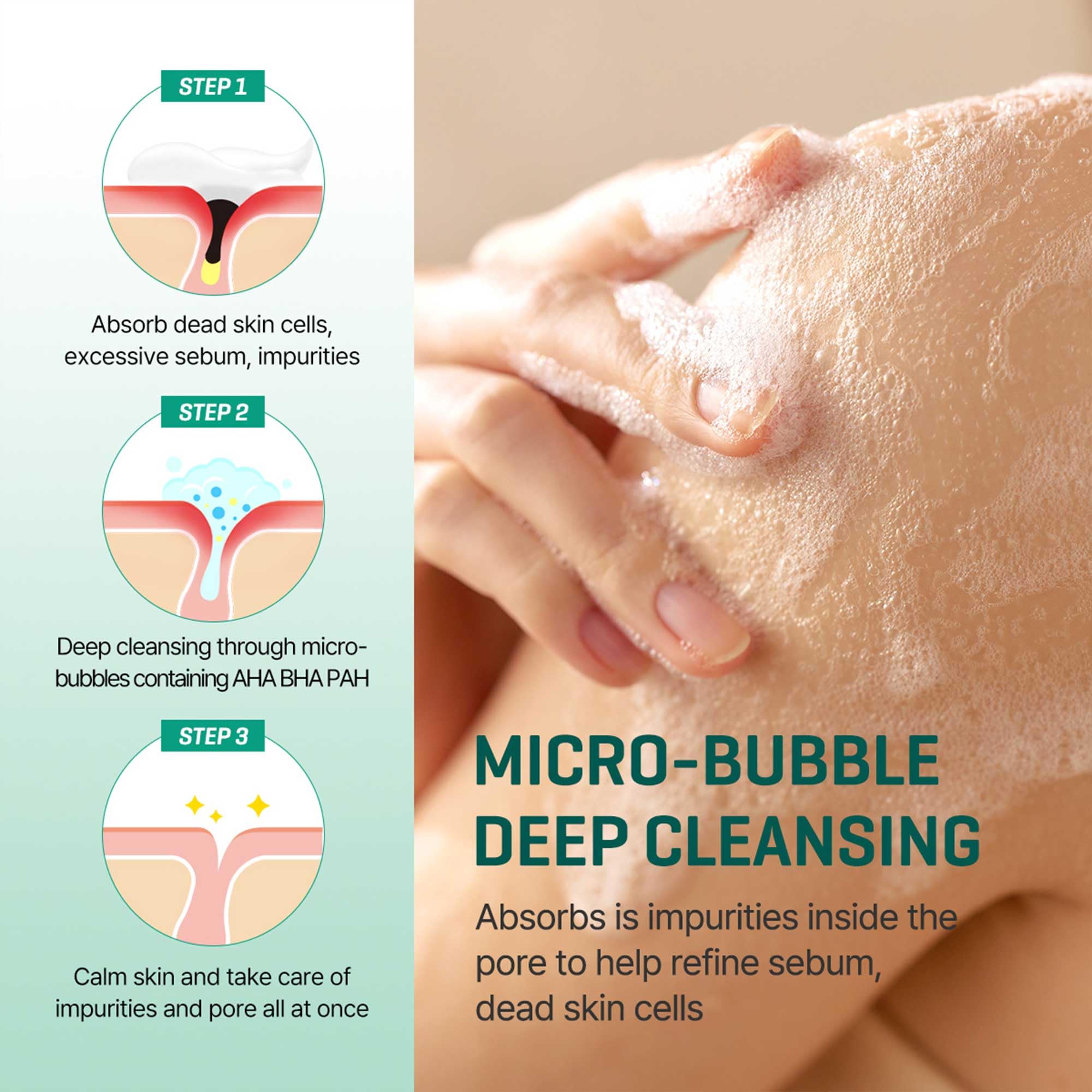 Some By Mi Aha Bha Pha 30 Days Miracle Acne Clear Body Cleanser - 13.5Oz, 400Ml - Mild Exfoliating Daily Acne Body Wash For Acne