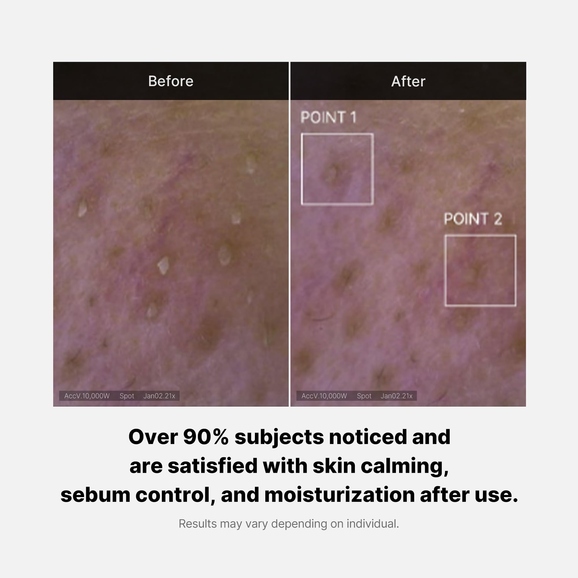 Medicube Red Foam Cleanser - Deeply Cleanses, Remove Impurities, Control Sebum, | Korean Skincare