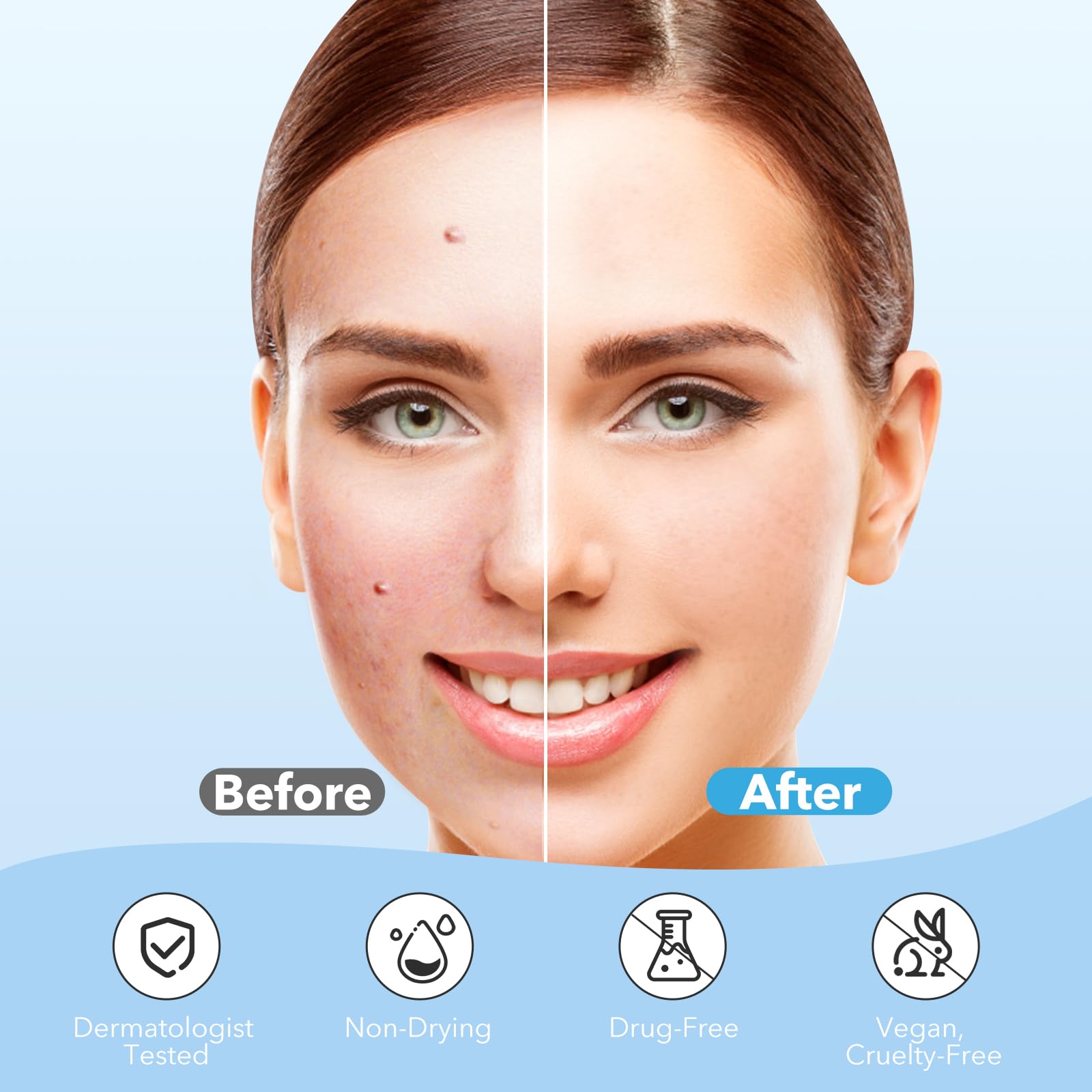 Qustere Pimple Patches For Face, Hydrocolloid Acne Patches, Cute Round Shape Zit Covers, Spot Stickers With Tea Tree, Salicylic