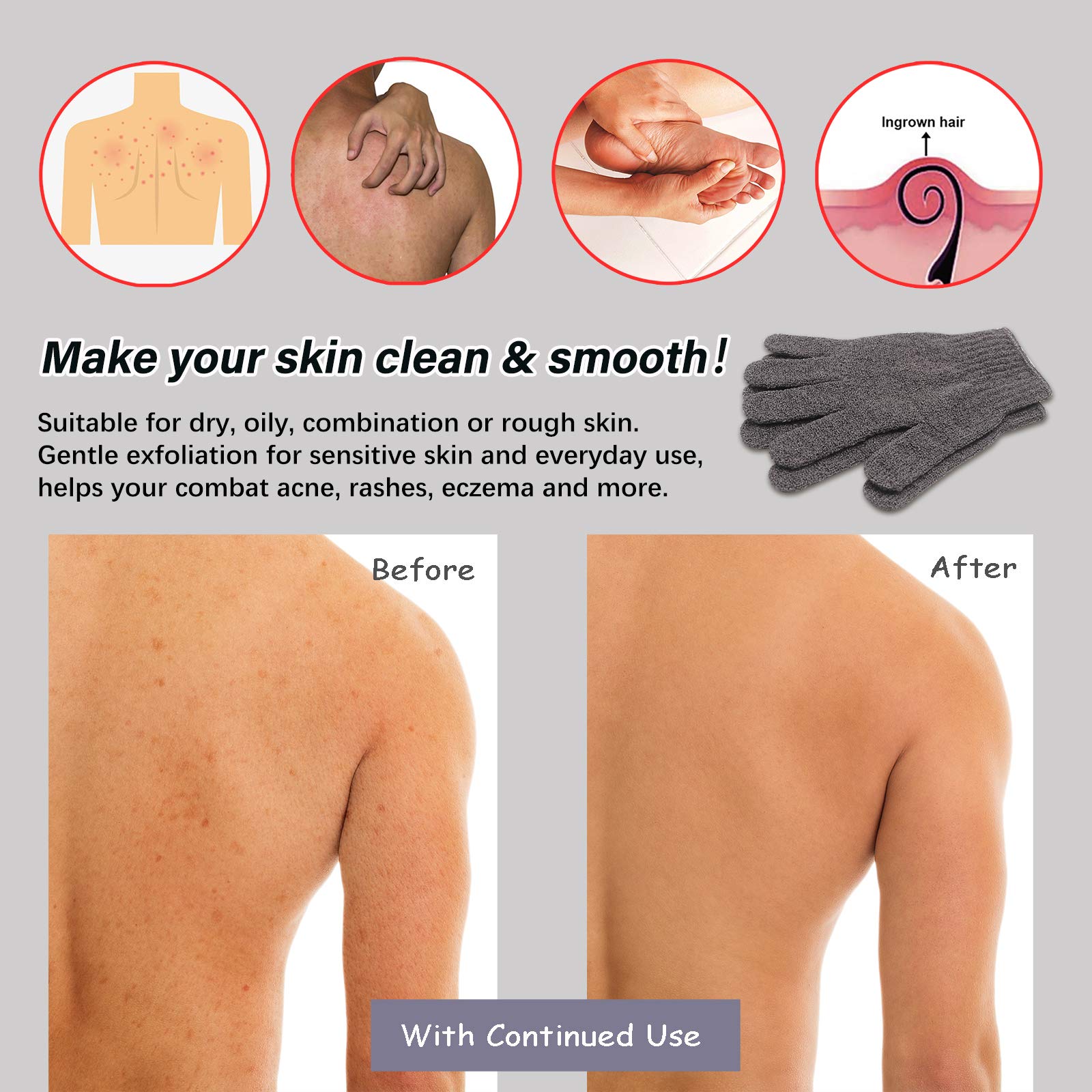 Mig4U Shower Exfoliating Scrub Gloves Medium To Heavy Bathing Gloves Body Wash Dead Skin Removal Deep Cleansing Sponge Loofah Fo