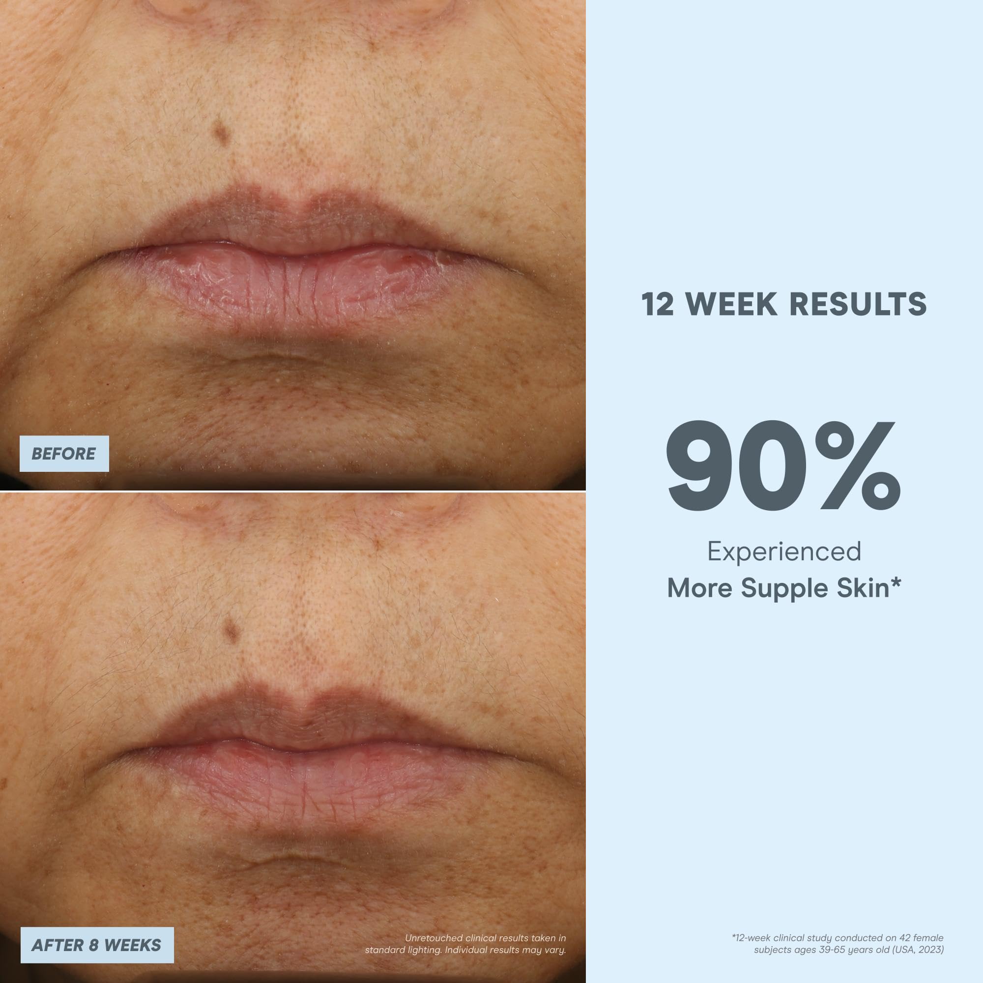 NuFACE Super Peptide Booster Face Serum - Skin Firming Peptide Serum for Fine Lines and Wrinkles - IonPlex Skin Care to Smooth,
