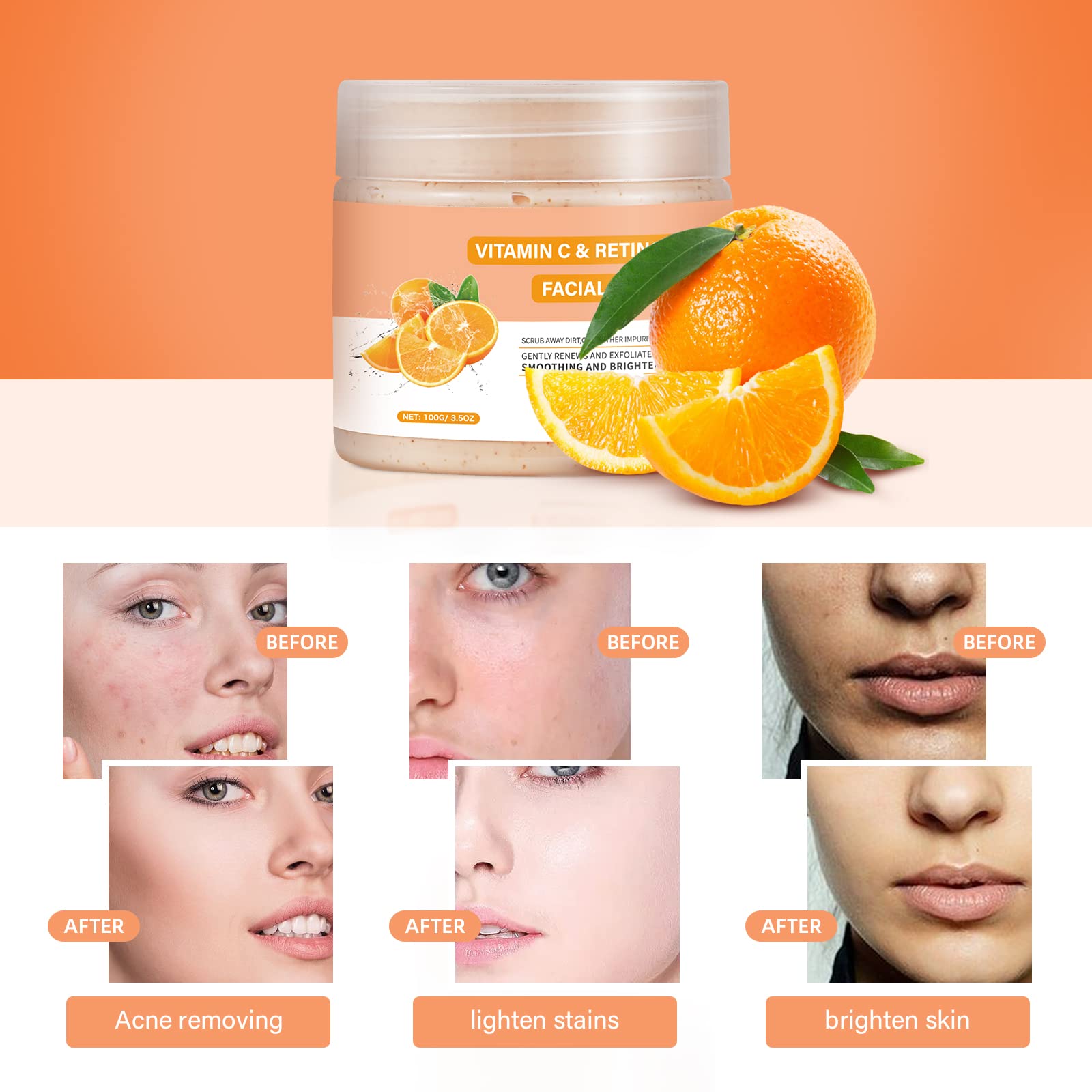 Vitamin C and Retinol Facial Scrub Face Scrub Exfoliating Face Wash Vitamin C Facial Body Scrub Microdermabrasion Facial Scrub F