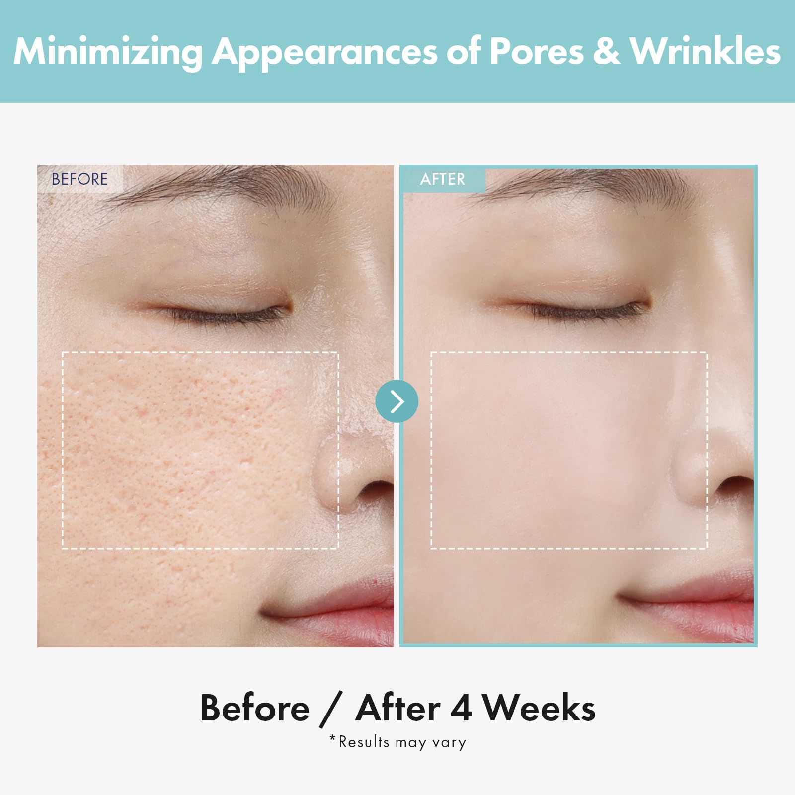 Tosowoong Pore Refiner Cream, Face Cream, Pore Extractor, Pore Minimize & Reducer And Remover. Best Pore Minimizer Treatment. Mo