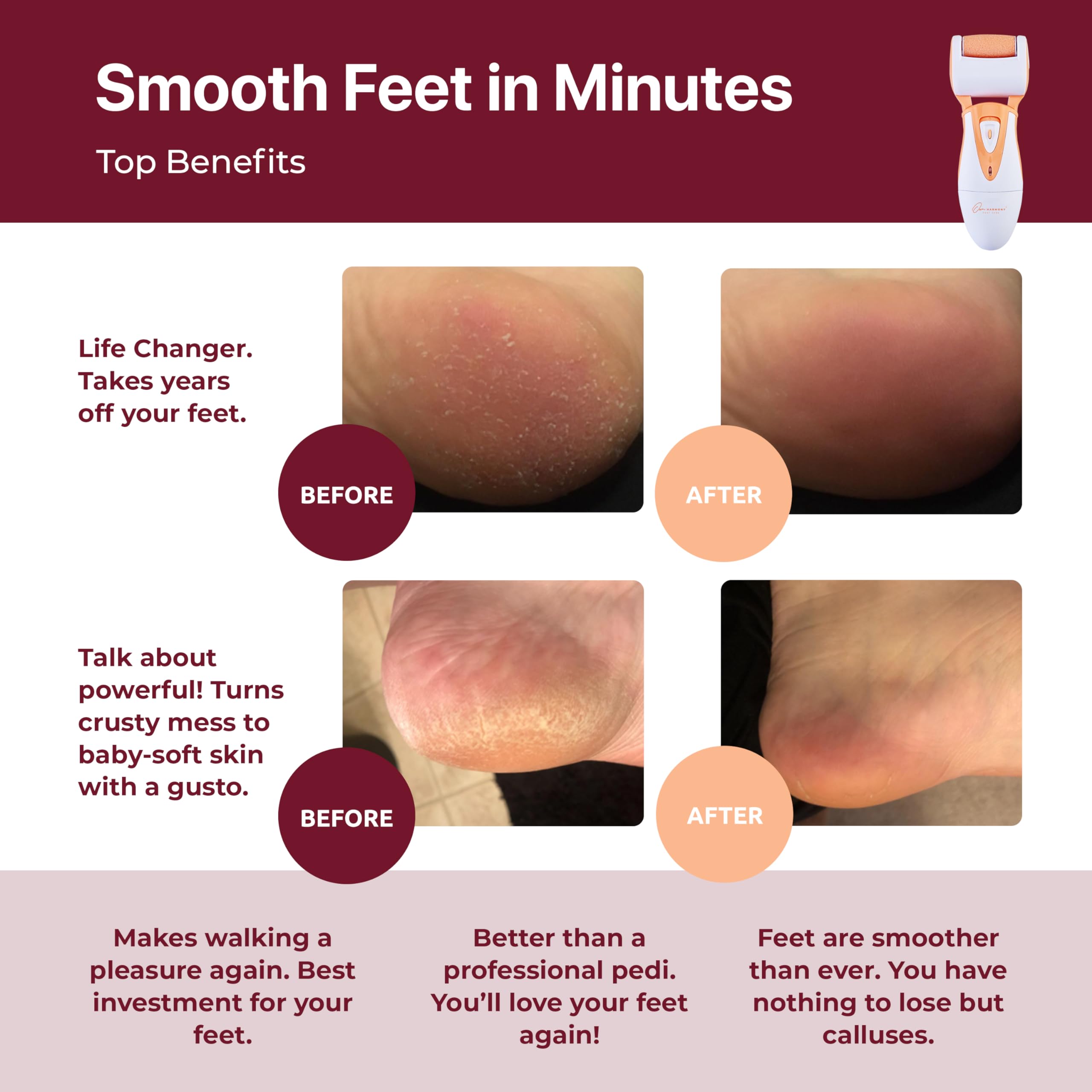 Own Harmony Professional Foot Care For Women: Rechargeable Callus Remover For Feet Electric Foot Sander - Electronic Foot File C