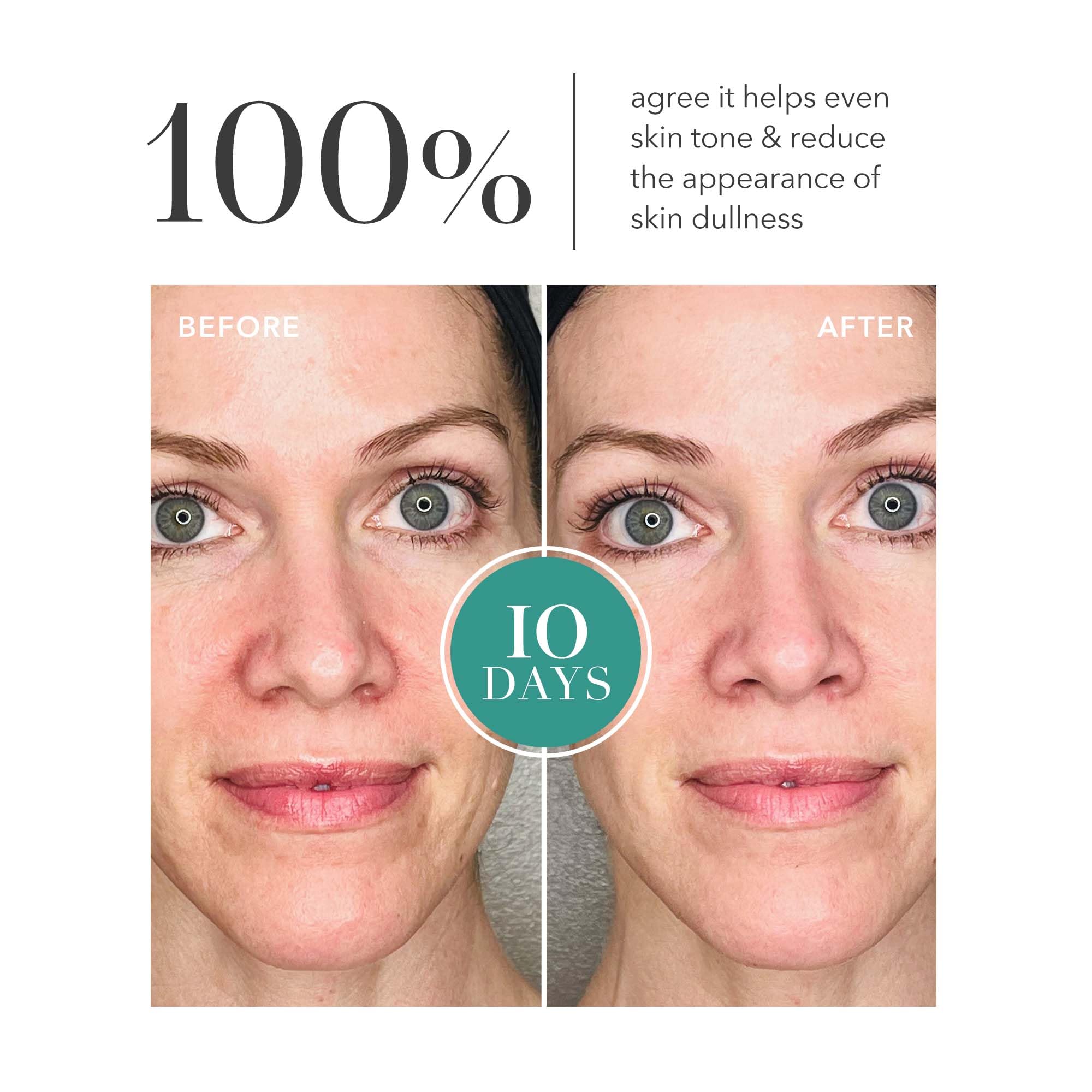 Algenist Genius Liquid Collagen Essence - Liquid Collagen Serum With Patented Alguronic Acid To Help Improve Skin Bounce, Elasti