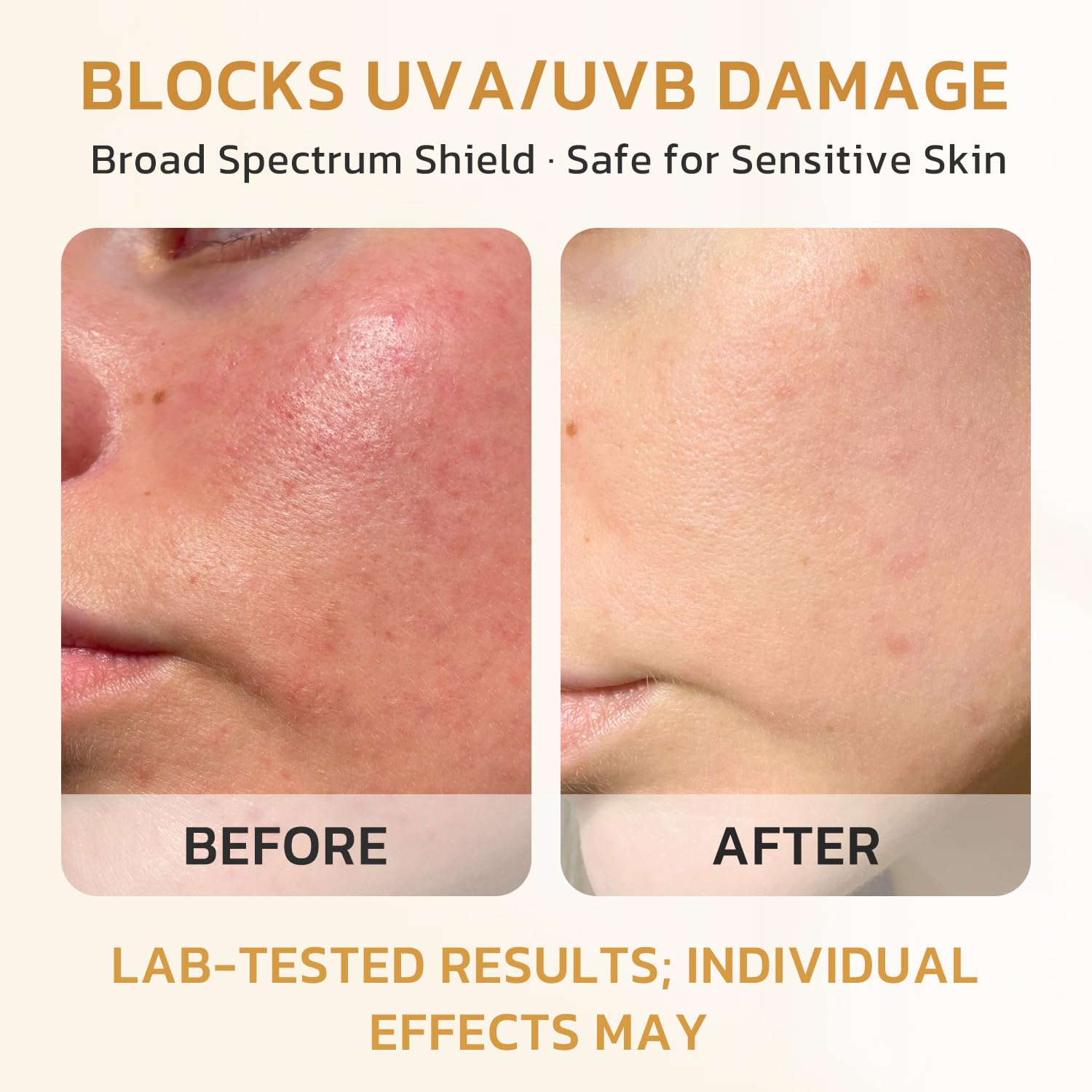 FIUMOT Gentle SPF 40 Daily Face Sunscreen, Broad Spectrum UVA/UVB Protection, Hydrating Facial & Body Sunscreen with Fermented R
