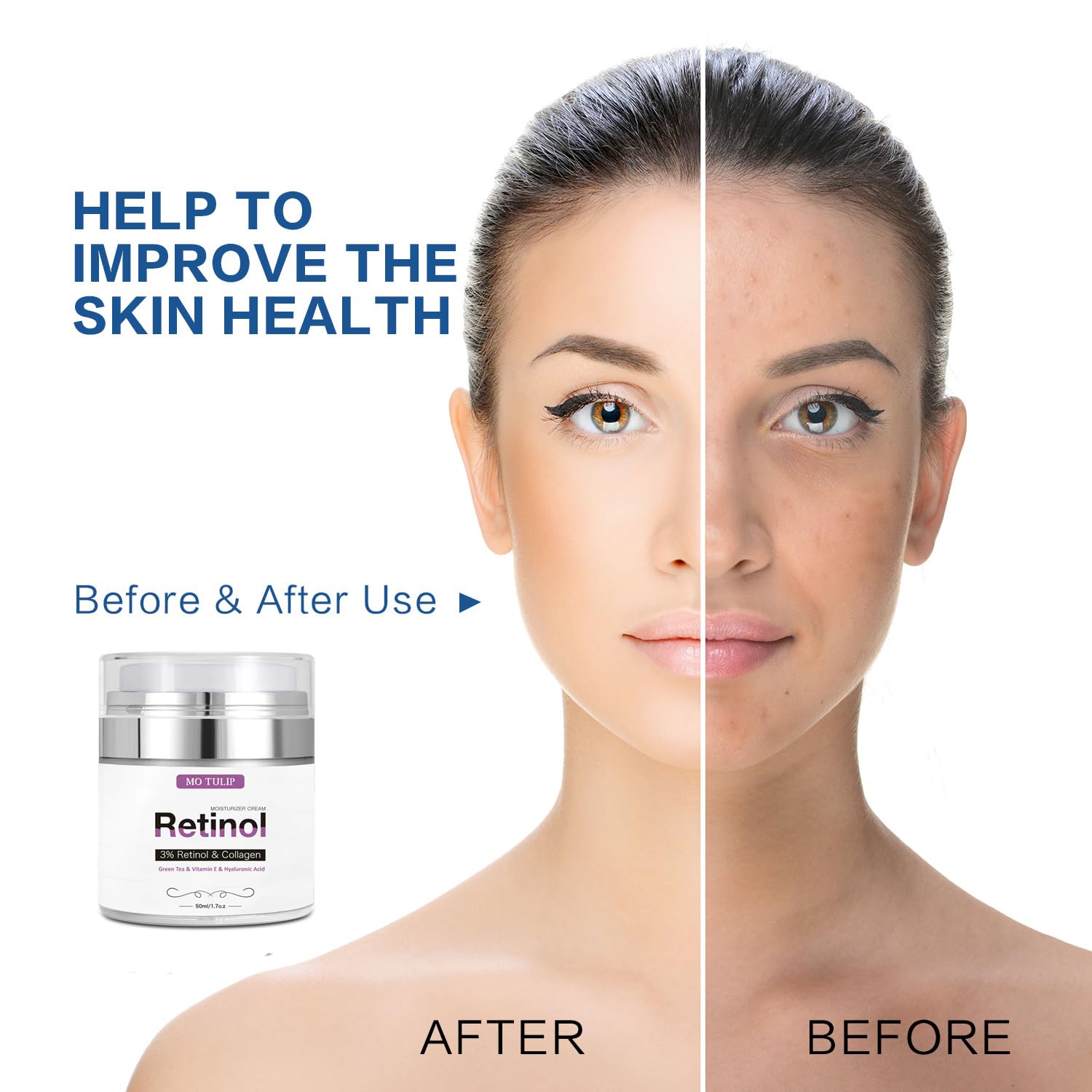 MO TULIP Face Cream with Retinol, Collagen & Hyaluronic Acid - Face & Neck Firming Moisturizer for Wrinkles, Hydration & Lifting