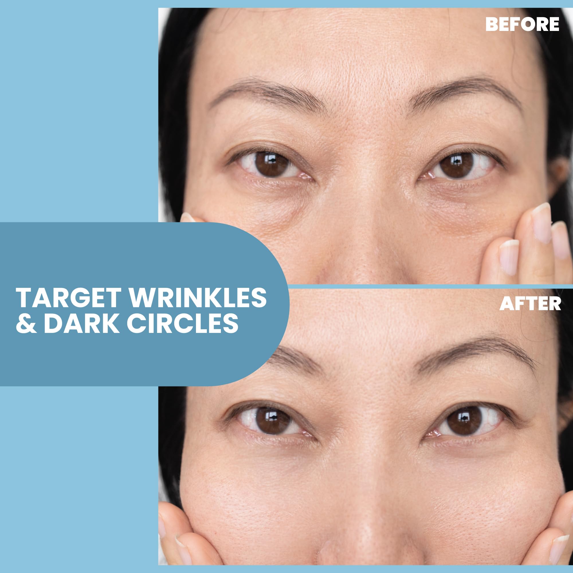 Eva Naturals Eye Gel for Dark Circles, Bags & Puffiness - Anti-Aging Serum with Peptides, Hyaluronic Acid & Botanicals - Firming