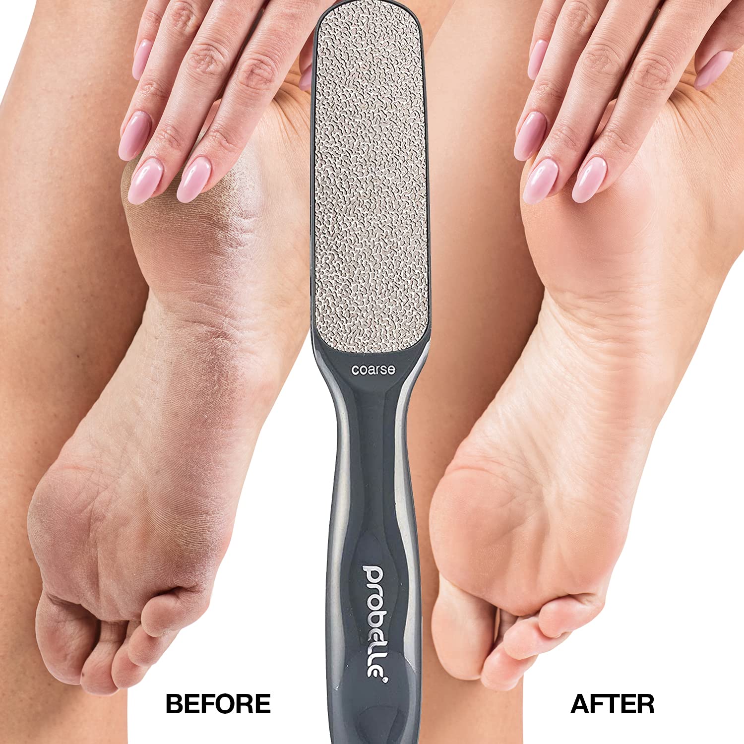 Probelle Double Sided Multidirectional Nickel Foot File Callus Remover - Immediately Reduces Calluses And Corns To Powder For In