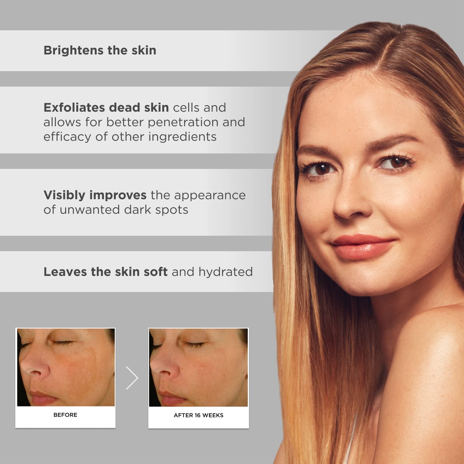 Glytone Enhance Brightening Complex - With 12% Azelaic Acid, 3% Glycolic Acid - Brightens Skin & Reduces Dark Spots - Non-Comedo