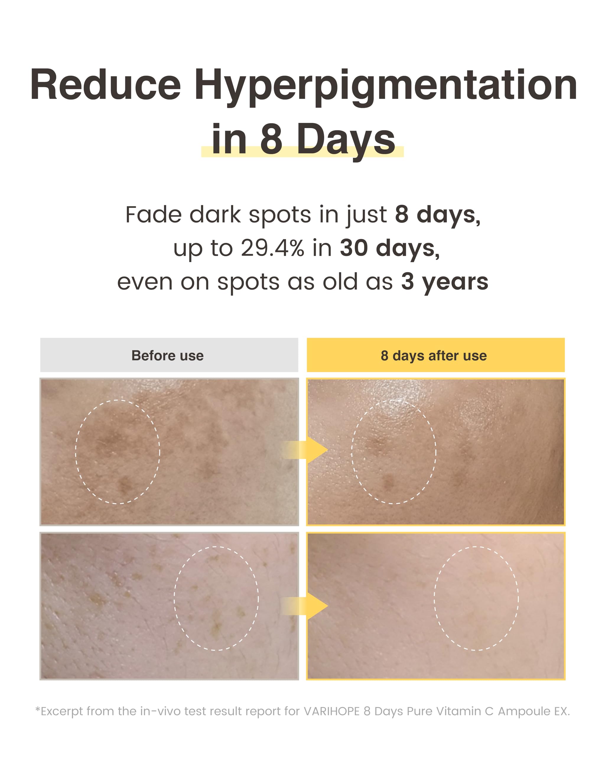 Varihope 8 Days Vitamin C Serum (0.5Oz) - Facial Serum For Dark Spots With Pure Face Ampoule. Korean Brightening, Glowing Skin C