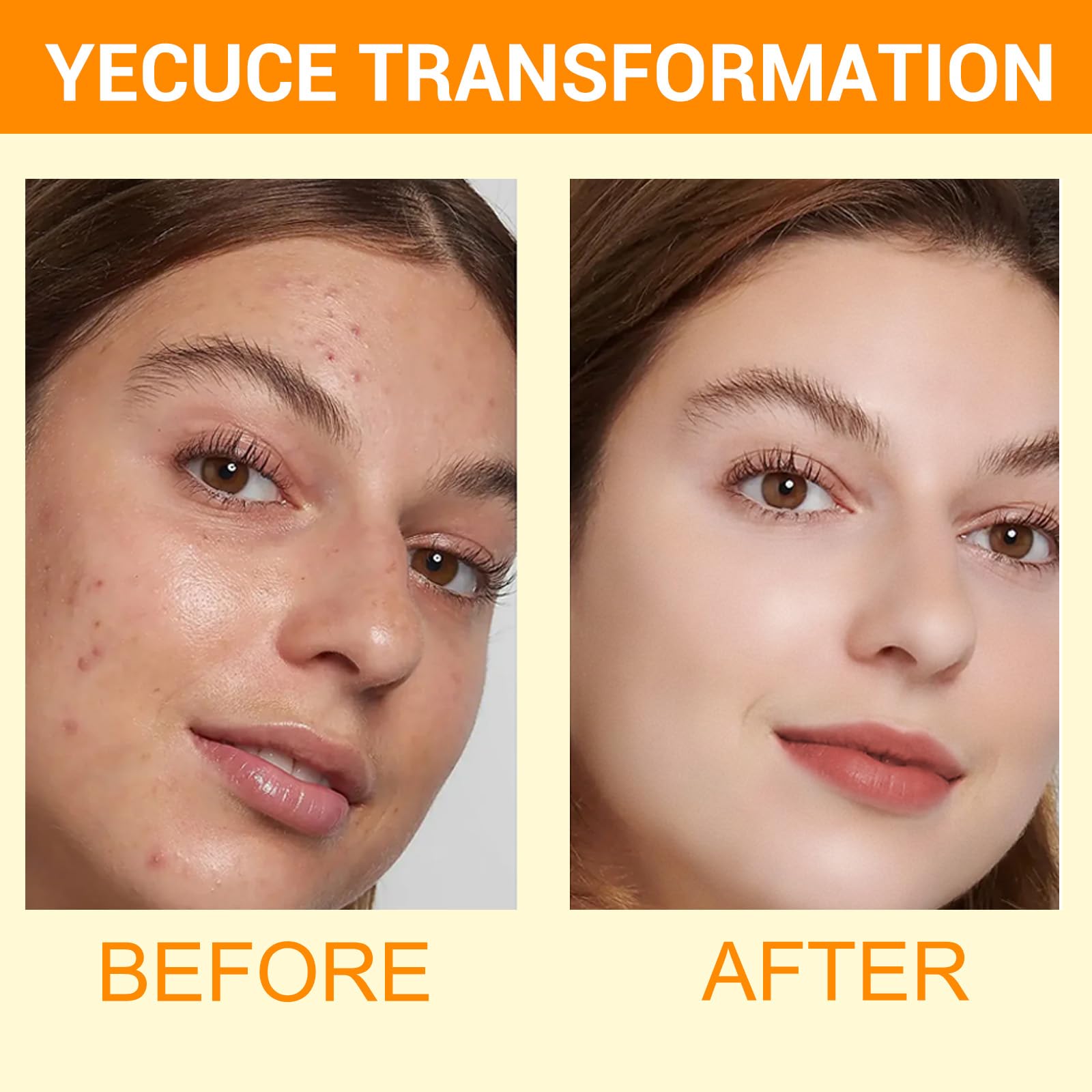 A R B C R N Turmeric Cleansing Mousse,Kojic Acid Facial Cleanser For Fce Wash And Firming Skin,Remove Excess Keratin-Deep Clean
