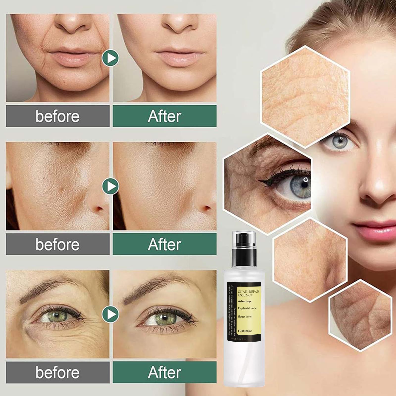 Snail Mucin Essence, With 96.3% Snail Secretion Filtrate, Power Repairing Serum For Fine Lines & Dull Skin & Acne, Replenish Wat