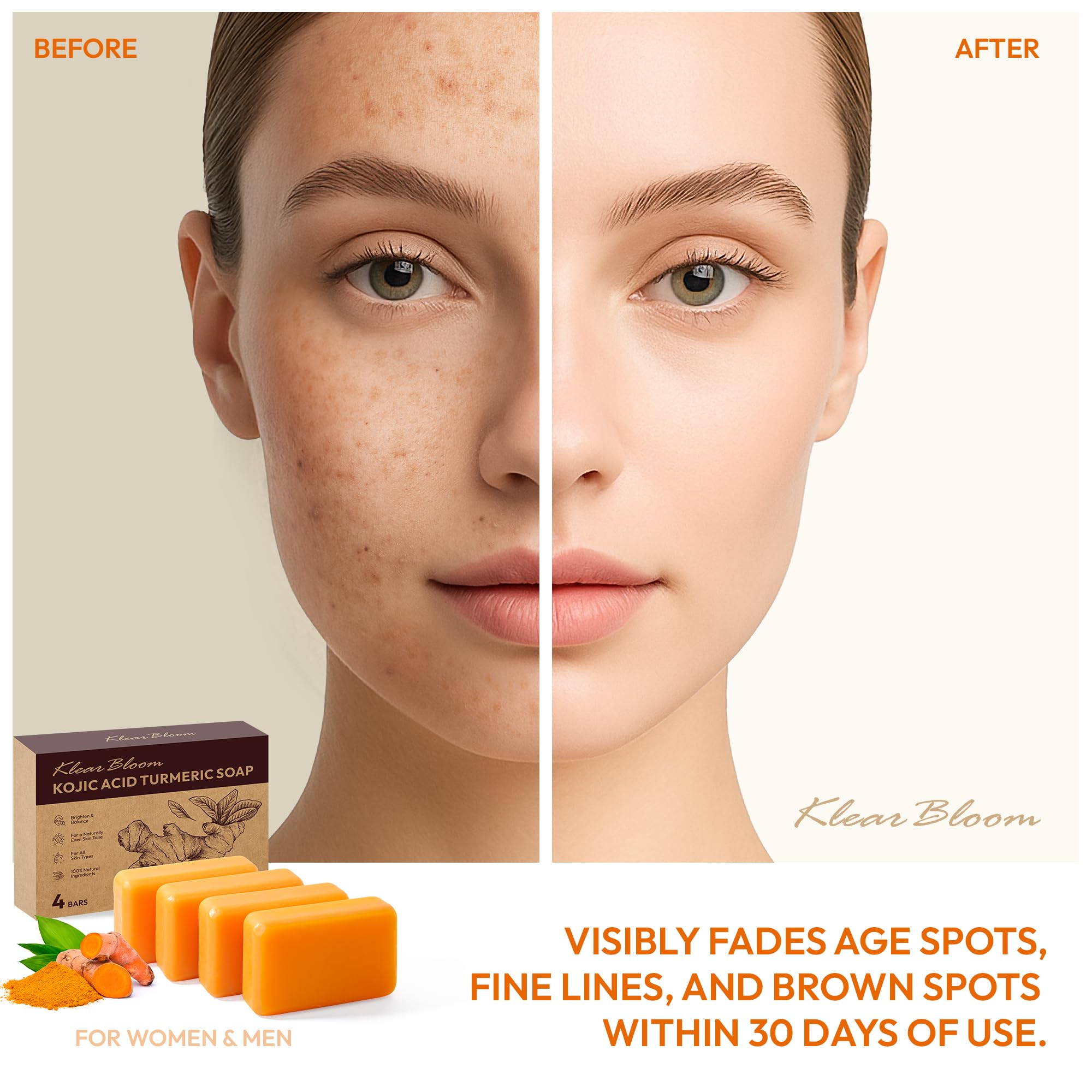 KlearBloom Kojic Acid Soap, Turmeric Soap Bar for Dark Spots Brightening & Moisturizing with Collagen, Vitamin E, Retinol, Hyalu