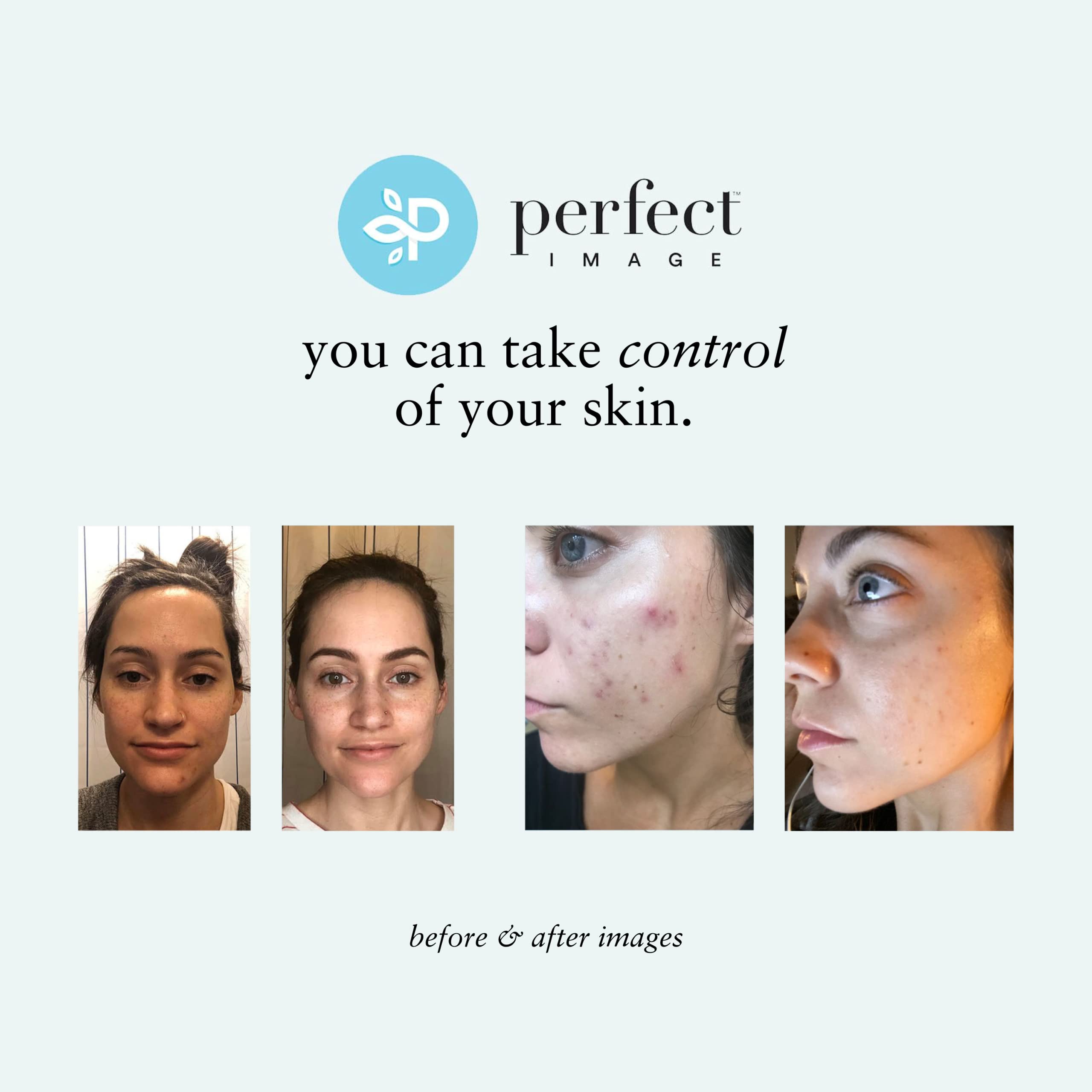 Perfect Image Salicylic Acid Deep Exfoliating Gel Based Cleanser, Professionally Formulated Salicylic Acid Peel Peel Prep Cleans