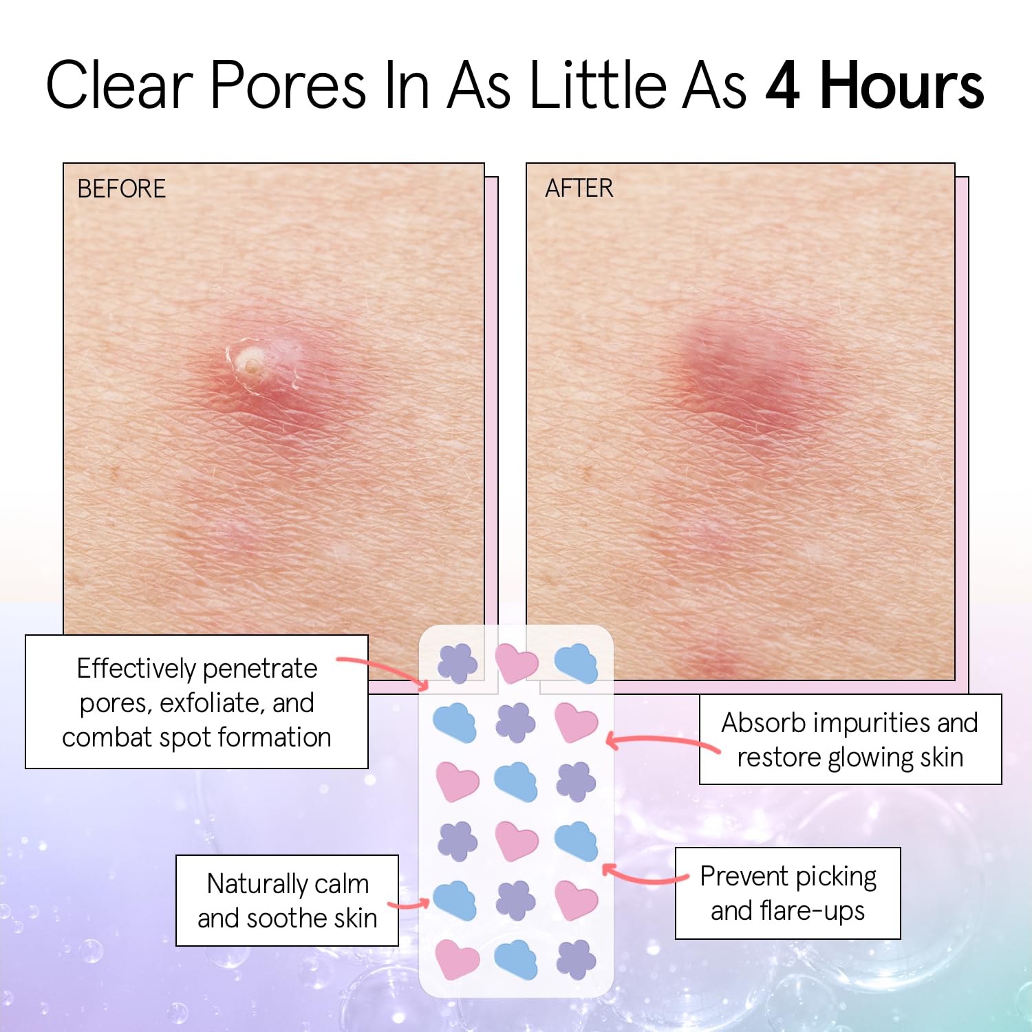 Grace & Stella Pimple Patches For Face (Multishape, 36 Count) - Hydrocolloid Acne Patches For Face - Dermatologist Tested, Vegan