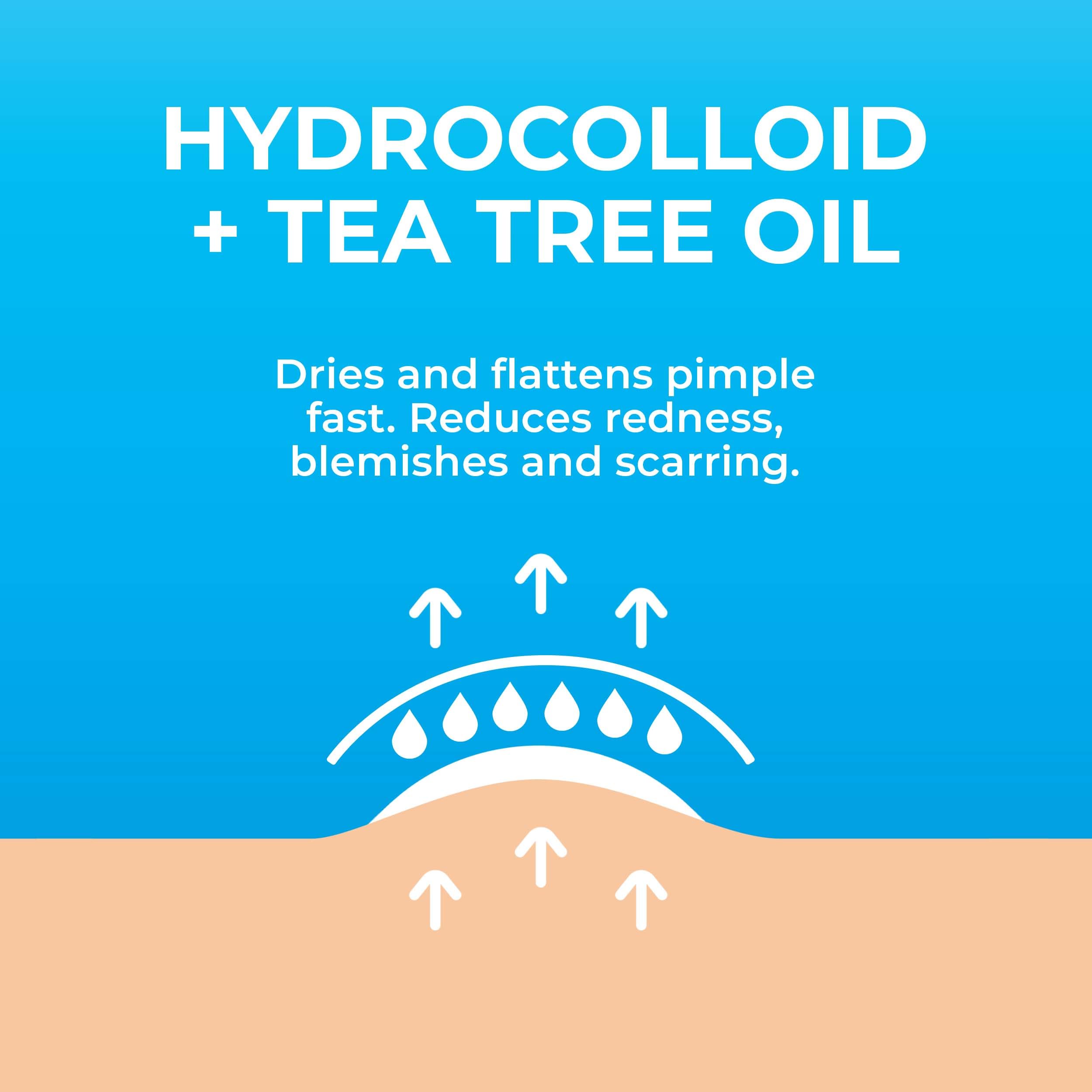 KEYCONCEPTS Pimple Patches for Face (120 Patches), Hydrocolloid Acne Patches with Tea Tree Oil, Pimple Patch Pimple Stickers - H