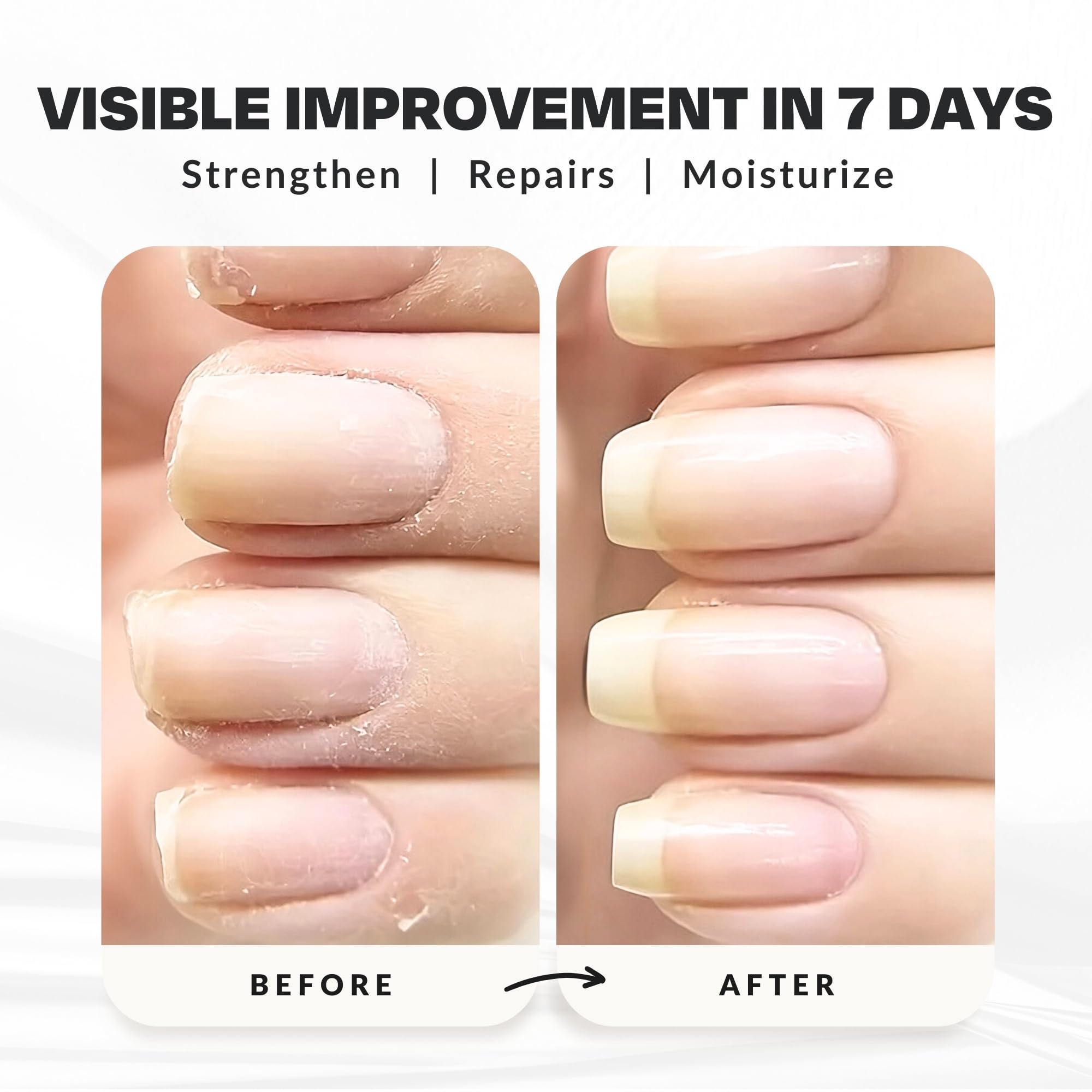 Nail Strengthener Power Boost Growth Formula, Keratin, Biotin, & Vitamin E, 21- Free, Repairs Damaged Nails, Stops Peeling & Chi