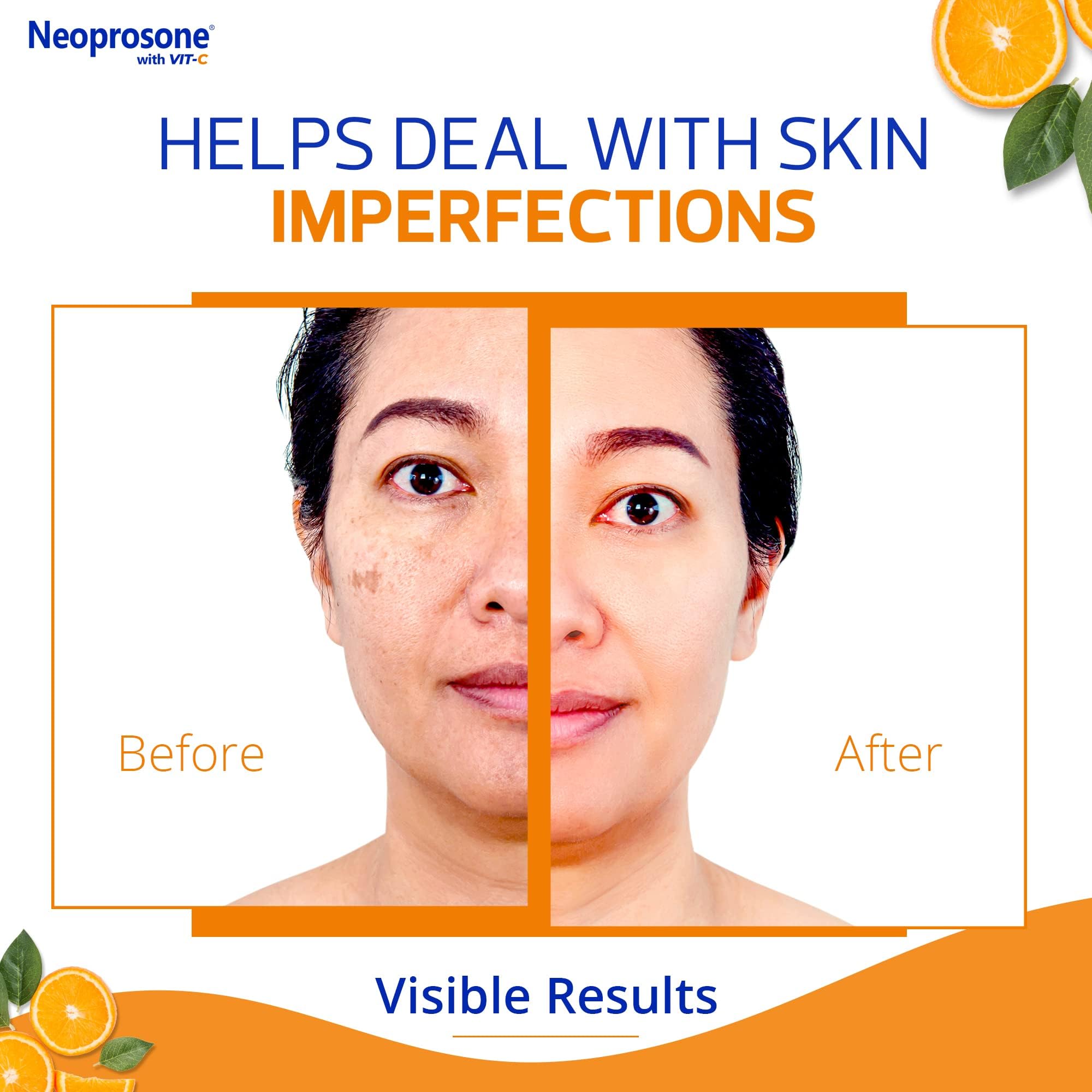 Neoprosone 20% Vitamin C Dark Spot Corrector Cream - 1 Fl Oz / 30Ml - Skin Brightening Gel Cream - With Hyaluronic Acid, Vitamin