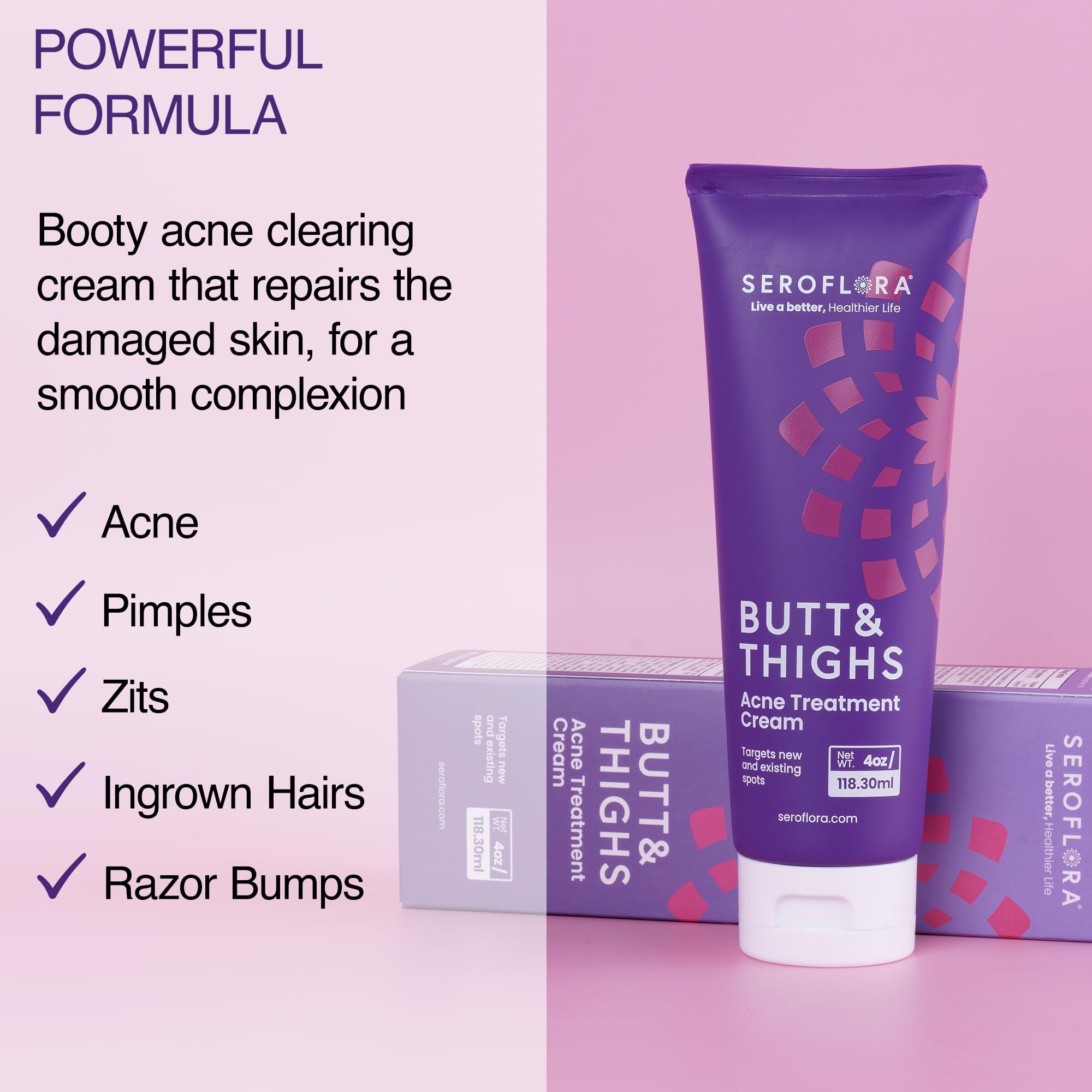Seroflora Butt & Thighs Acne Treatment Cream - Butt Acne Clearing Cream for Pimples, Zits, Razor Bumps, Dark Spots - Acne Cleari