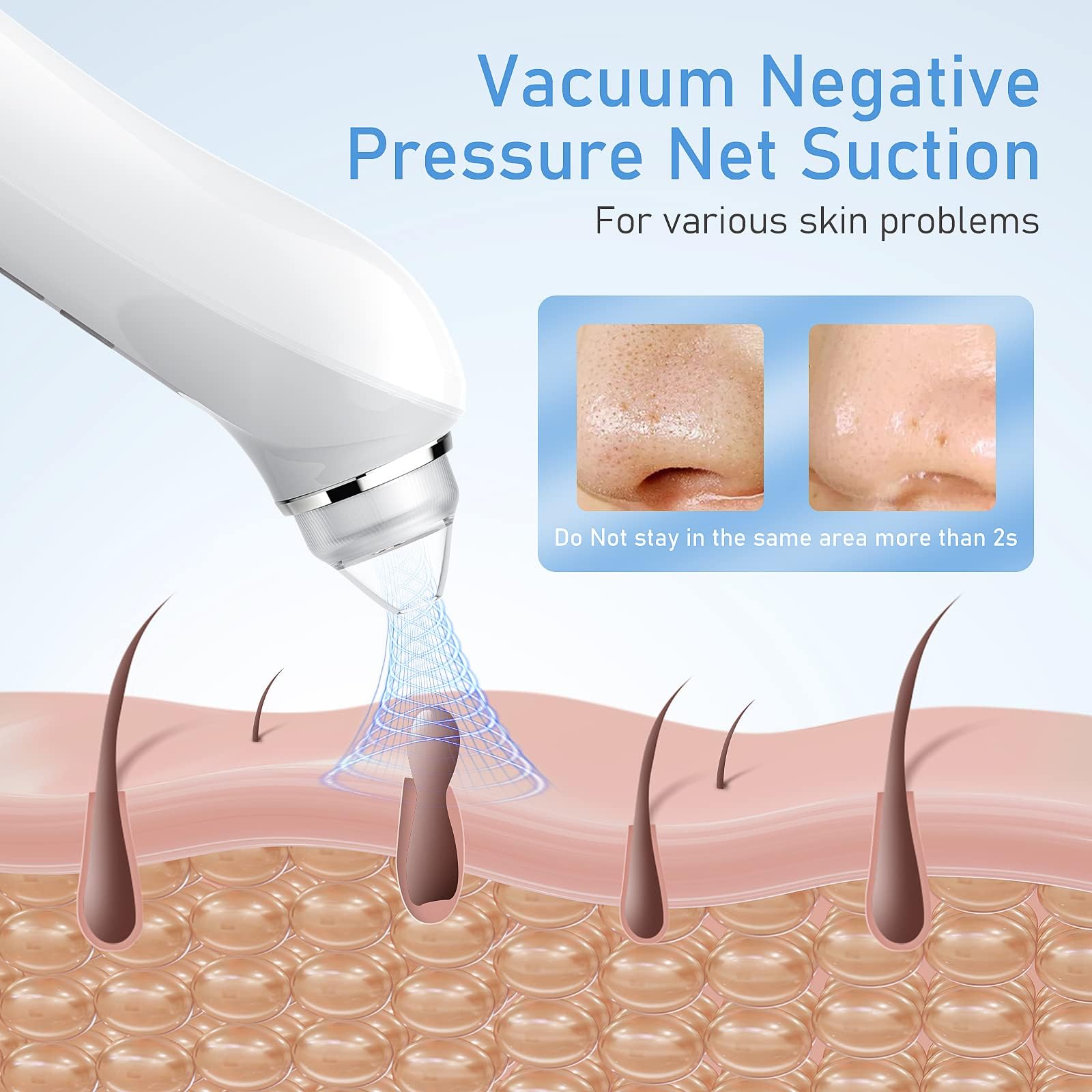 Facial Pore Blackhead Remover Vacuum, 1080P Camera Blackhead Remover, 20x Zoom, 8 LEDs & 3 Suction Modes, 800mAh Battery & USB -