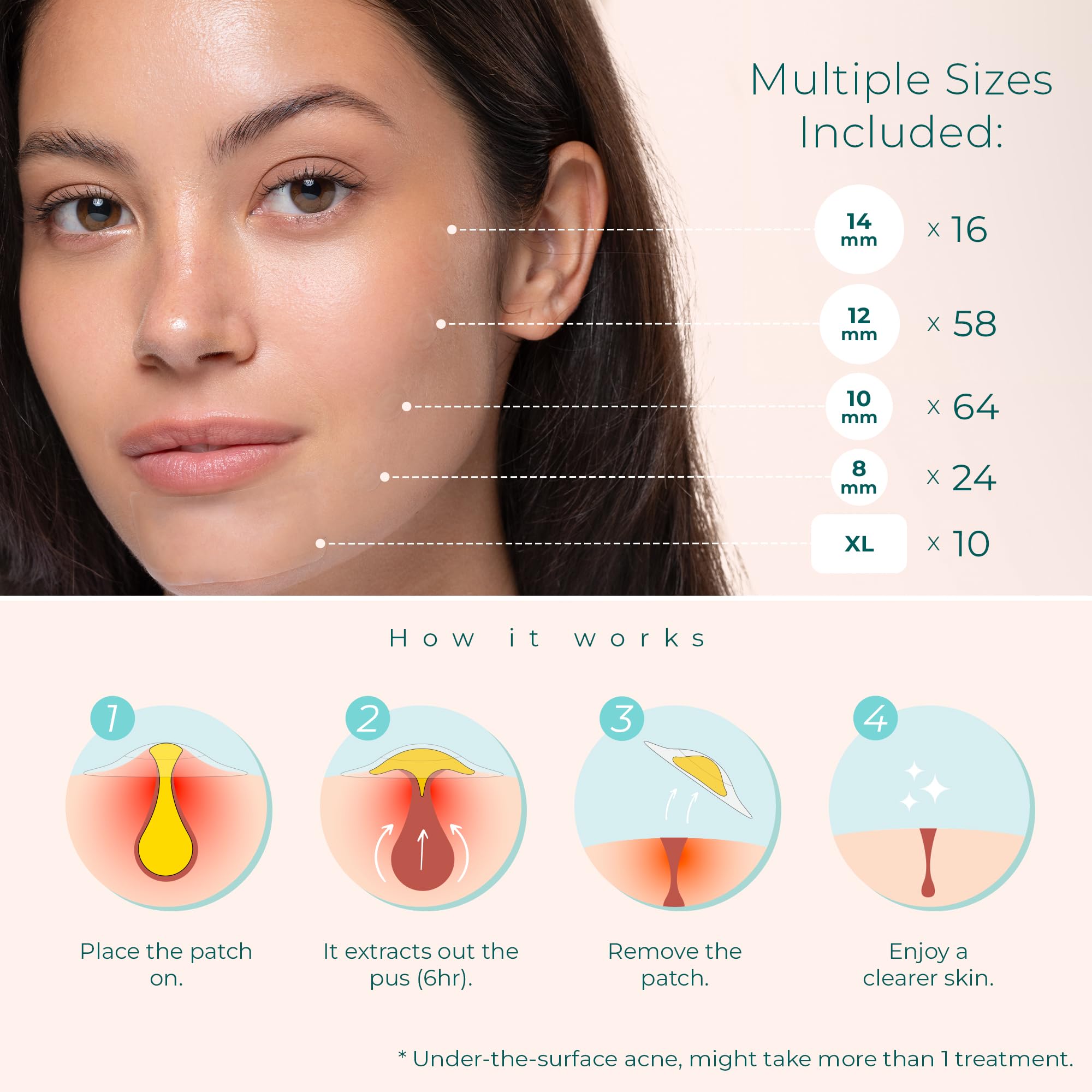 Pimple Patches for Face & Body - Overnight Treatment - Acne Patch for Zits, Dots, Bumps, Spots, Pimples, Whiteheads - Hydrocollo