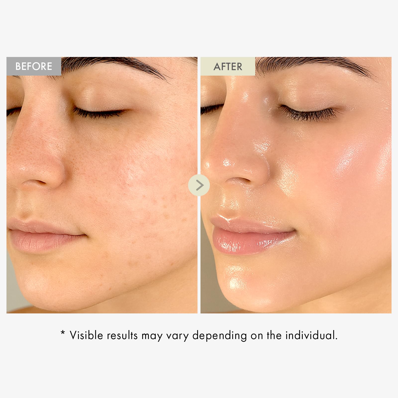 TOSOWOONG Real Collagen Face Serum, Hydrating & Firming Serum with hydrolyzed collagen, Hyaluronic Acid, Plumps, Sagging Skin, R