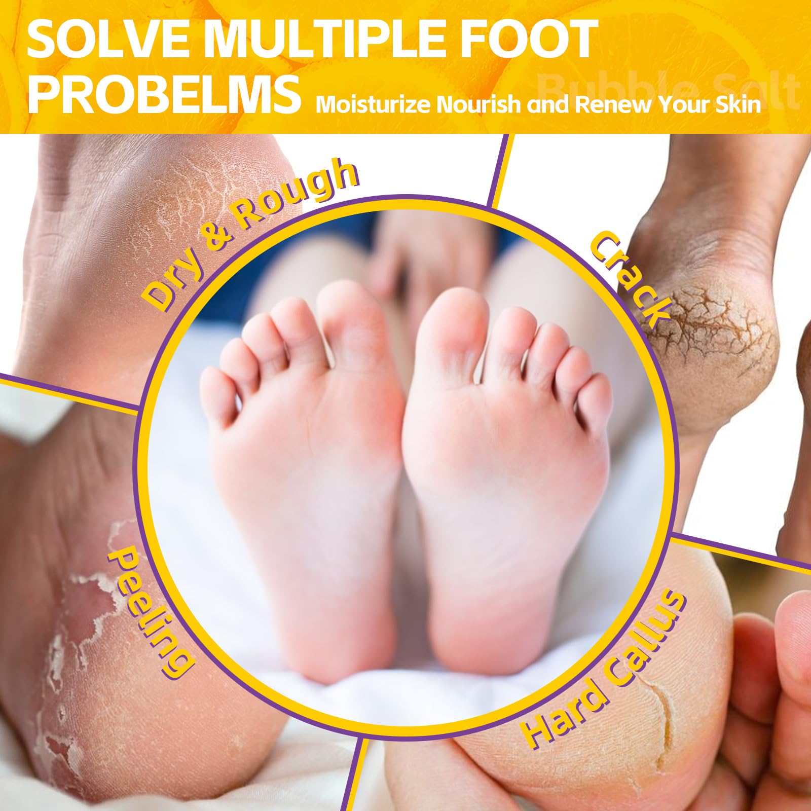 Nbc Beautilab Pedicure Foot Soak, Foot Spa Soak, Pedicure Kit, Bubble Foot Bath For Tired & Dry Cracked Feet, Athletes Feet, Odo