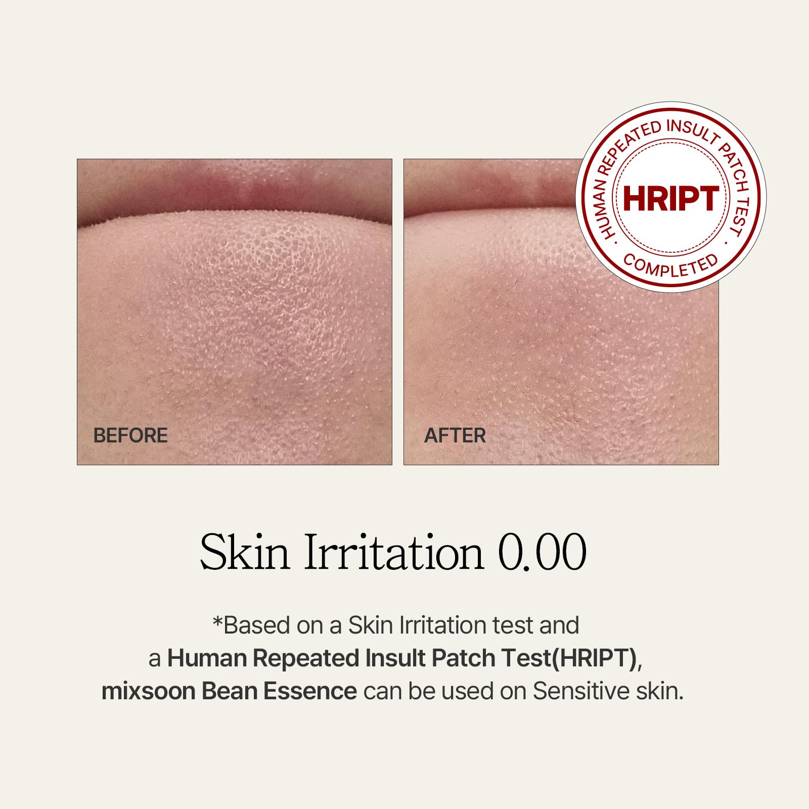 Mixsoon Bean Essence, Vegansnail, Exfoliating Essence For Face, Hydrating Korean Skin Care,Glassskin 1.69 Fl.Oz/50Ml