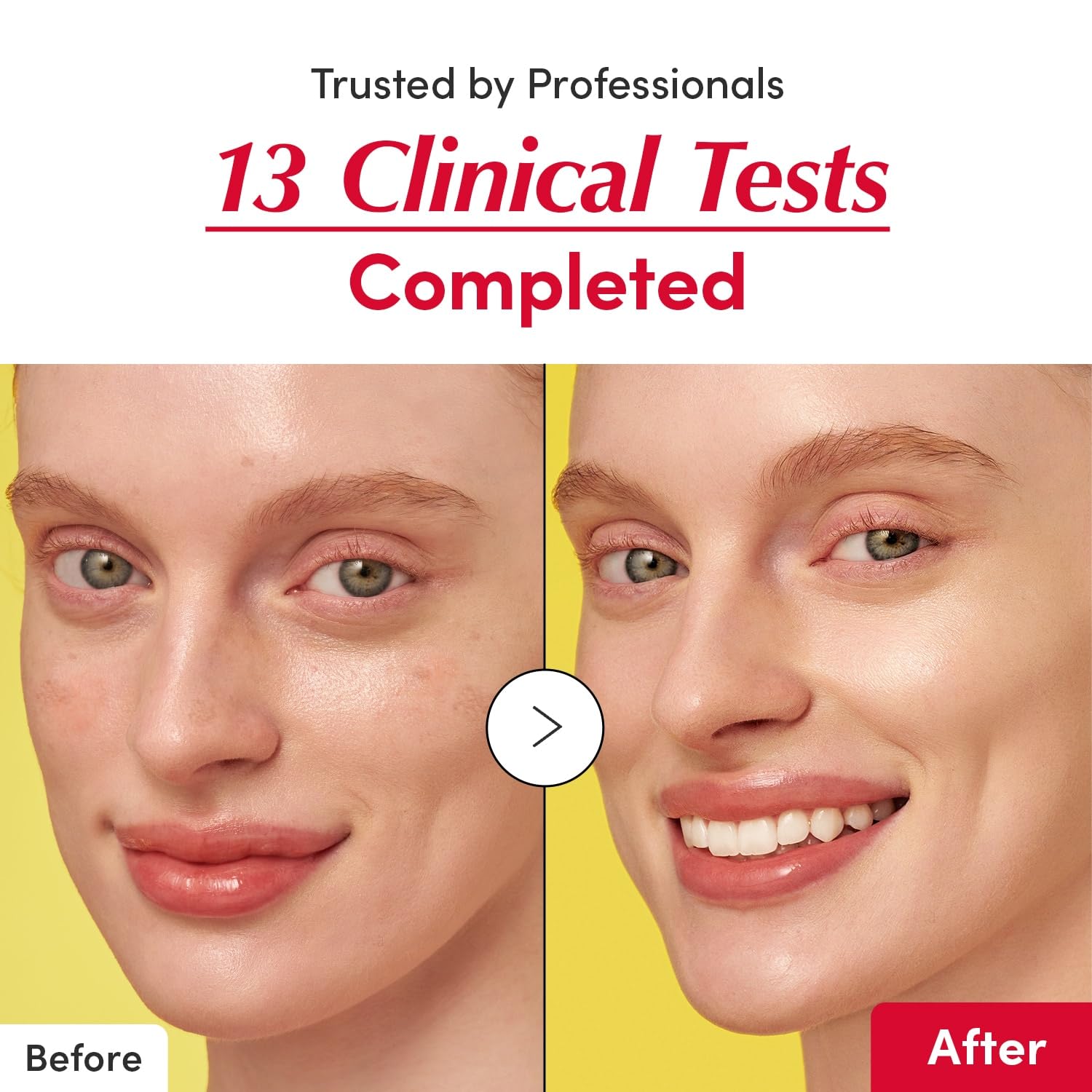 EQQUALBERRY Vitamin C Serum with Niacinamide, 1.01oz - Hydrating Illuminating Serum for Skin Barrier Strengthening